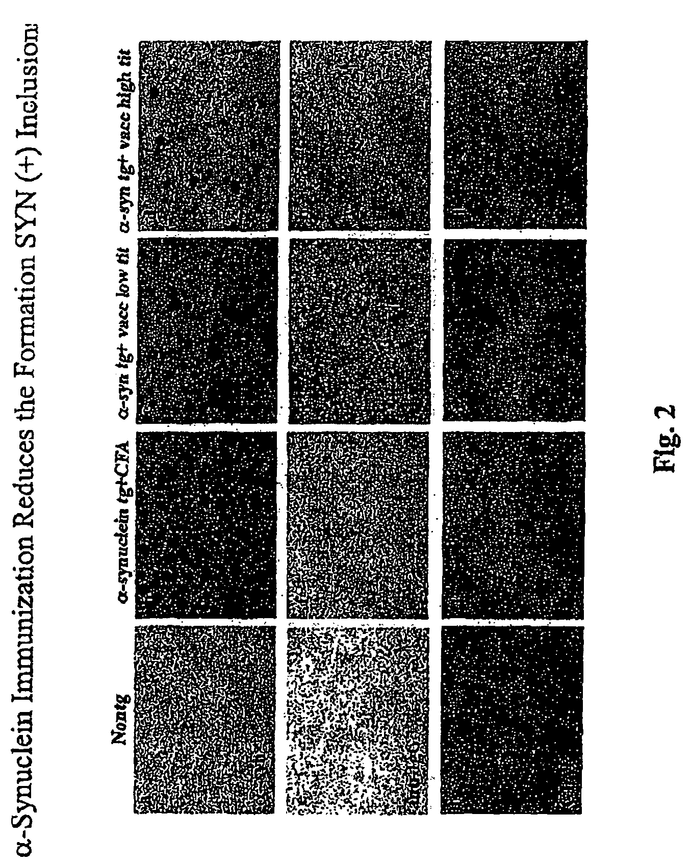 Prevention and treatment of synucleinopathic and amyloidogenic disease