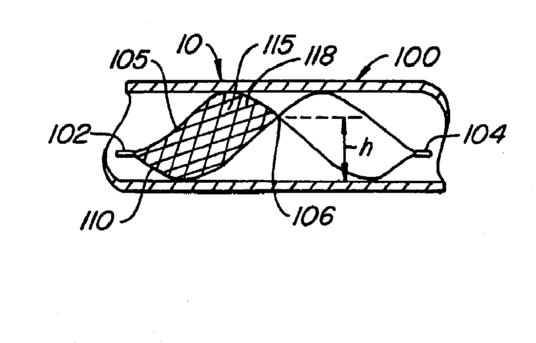 Spiral shaped filter