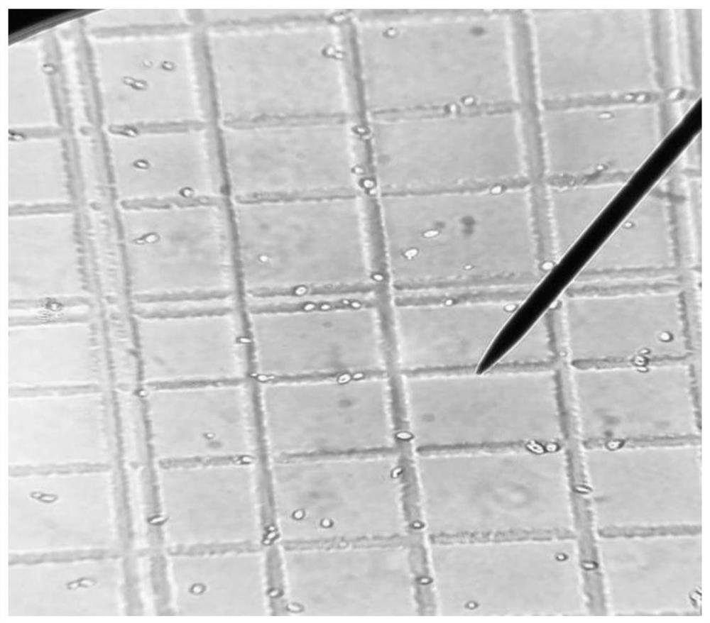 A kind of acid-resistant yeast and its application