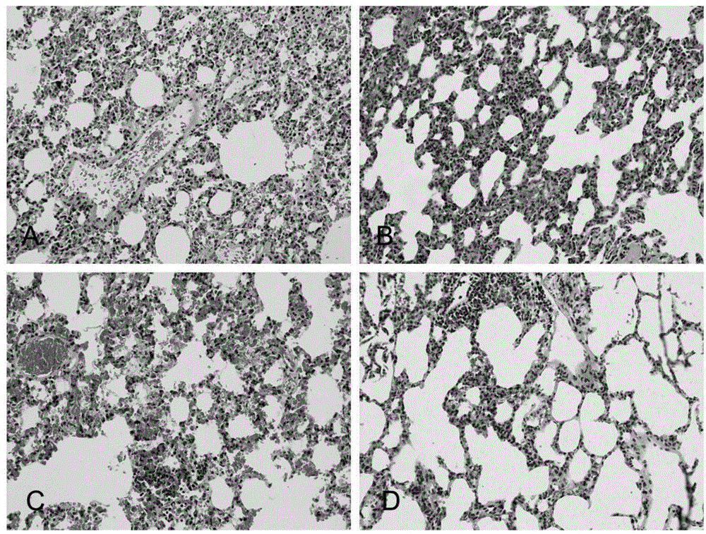 Application of N-acetylcysteine in preparing medicament for preventing decompression sickness caused by fast buoyant ascent escape