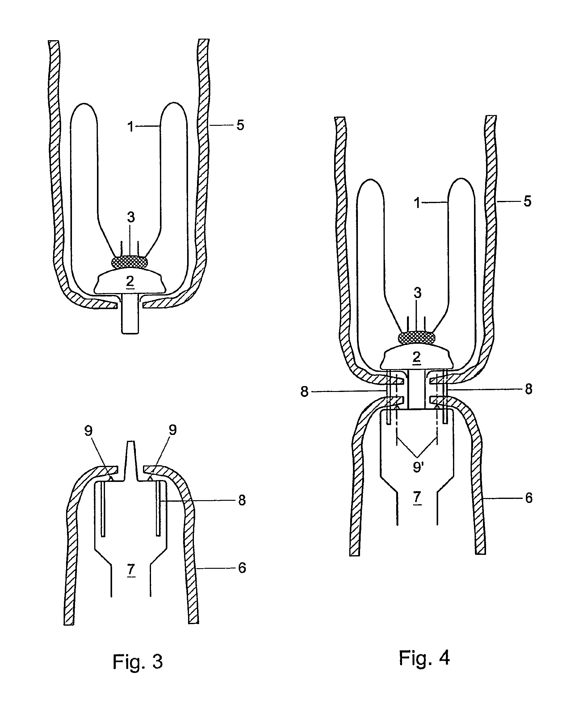 Devices and methods for anastomosis