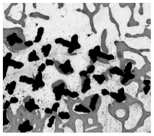 Porous metal implant containing artificial bone meal and preparation method of porous metal implant