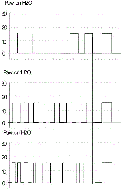 Lung recruitment maneuver ventilation control method and device