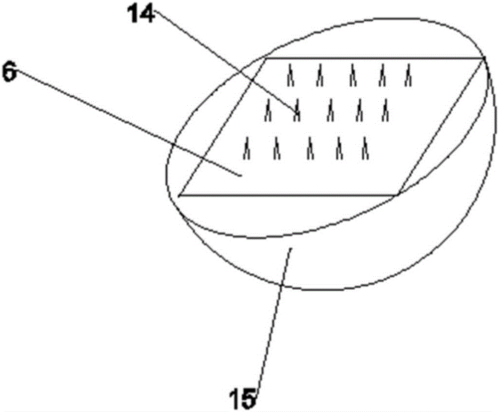 Novel cloud intelligent insulin pump system