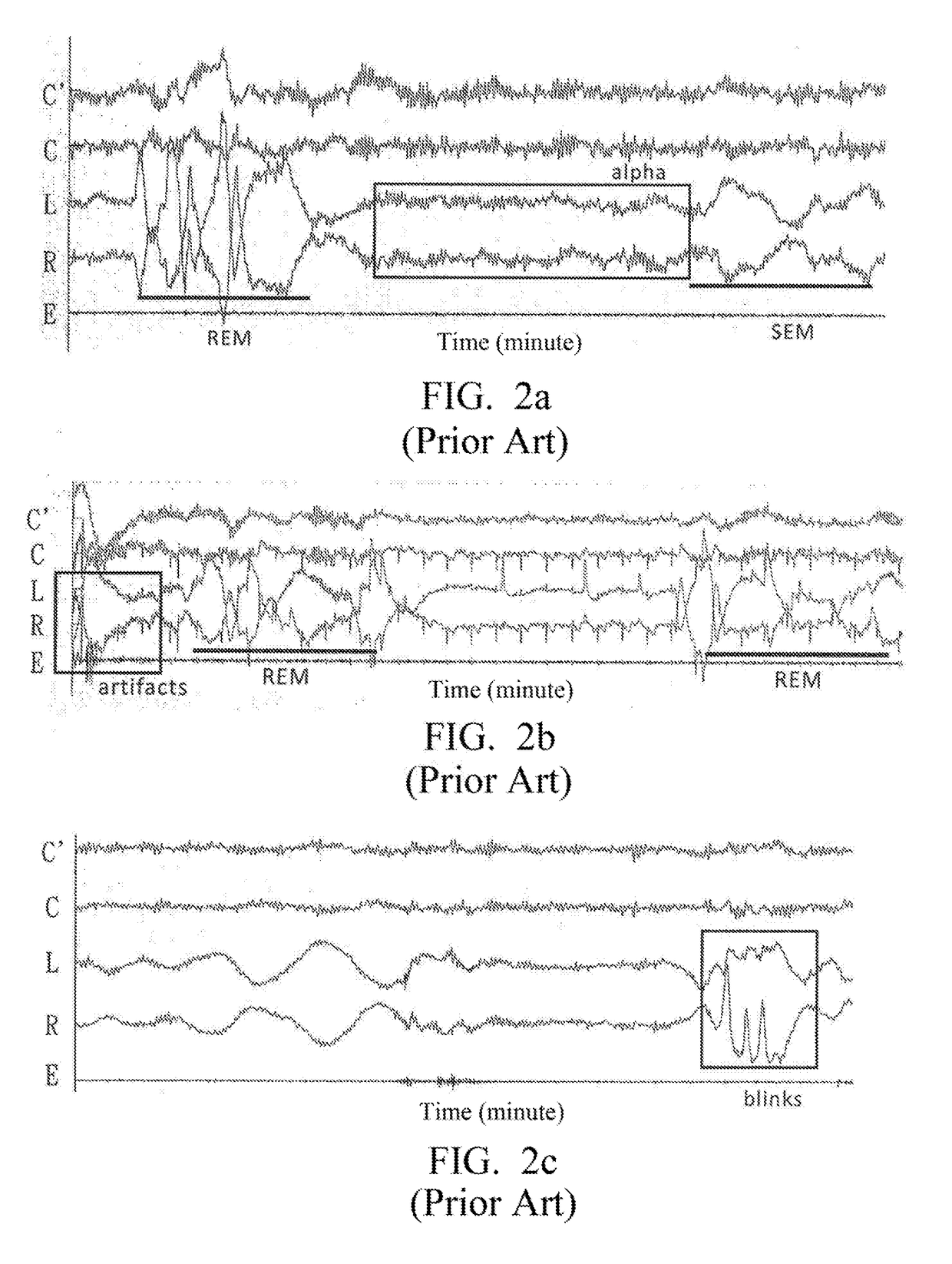 EOG-based Sleep Staging Method, Computer Program Product with Stored Programs, Computer Readable Medium with Stored Programs, and Electronic Apparatuses