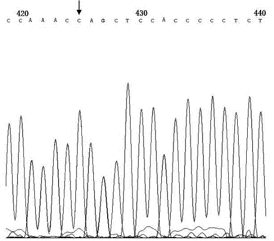 Genetic diagnosis kit for amyotrophic lateral sclerosis