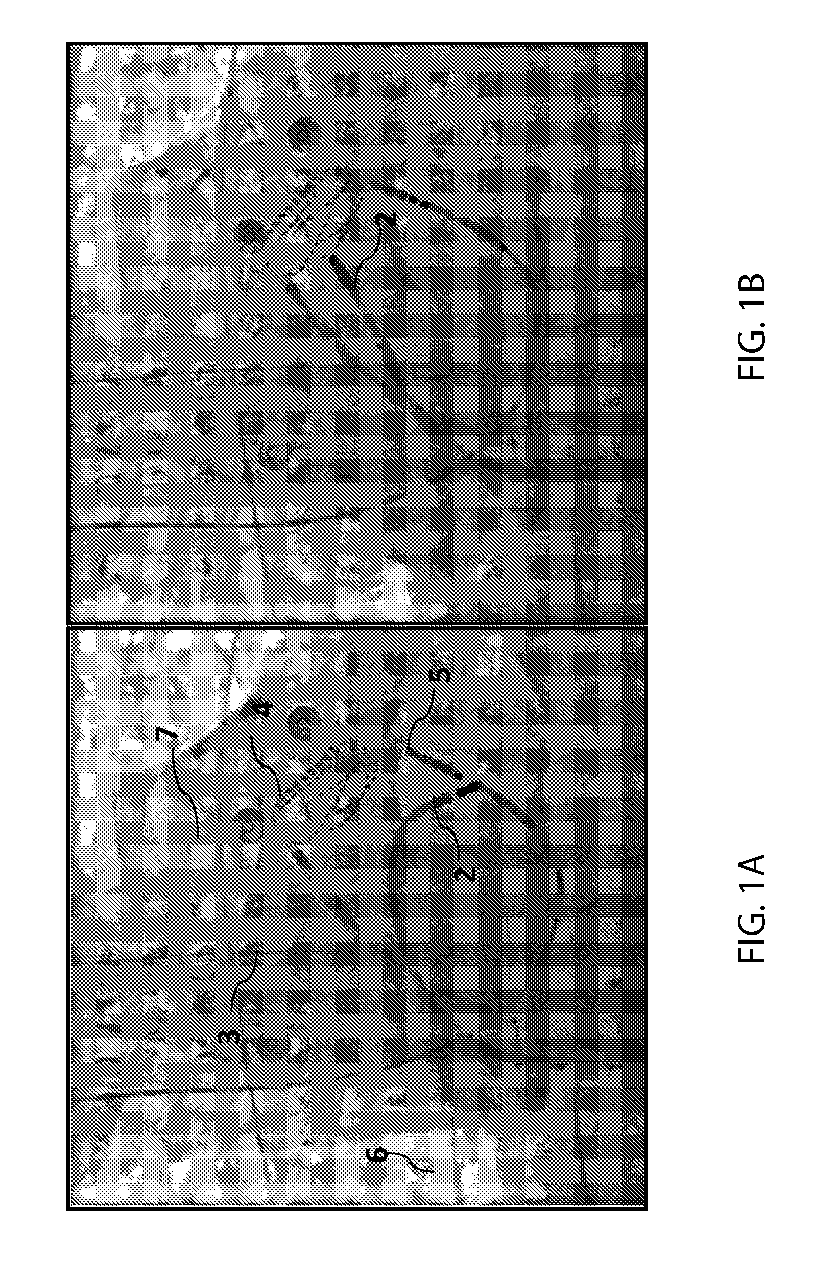 R-Wave Detection Method