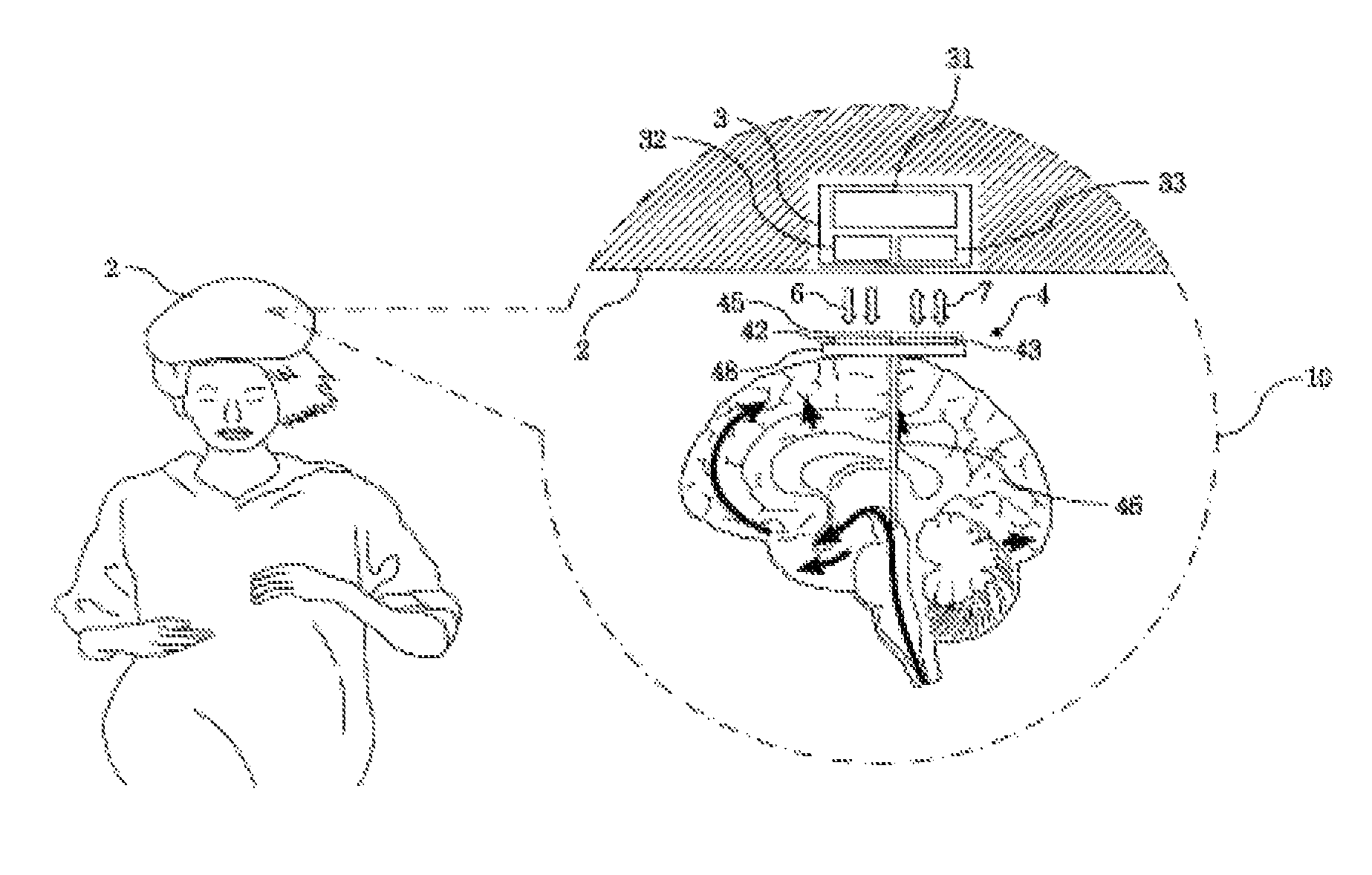 Neural electronic interface device for motor and sensory controls of human body