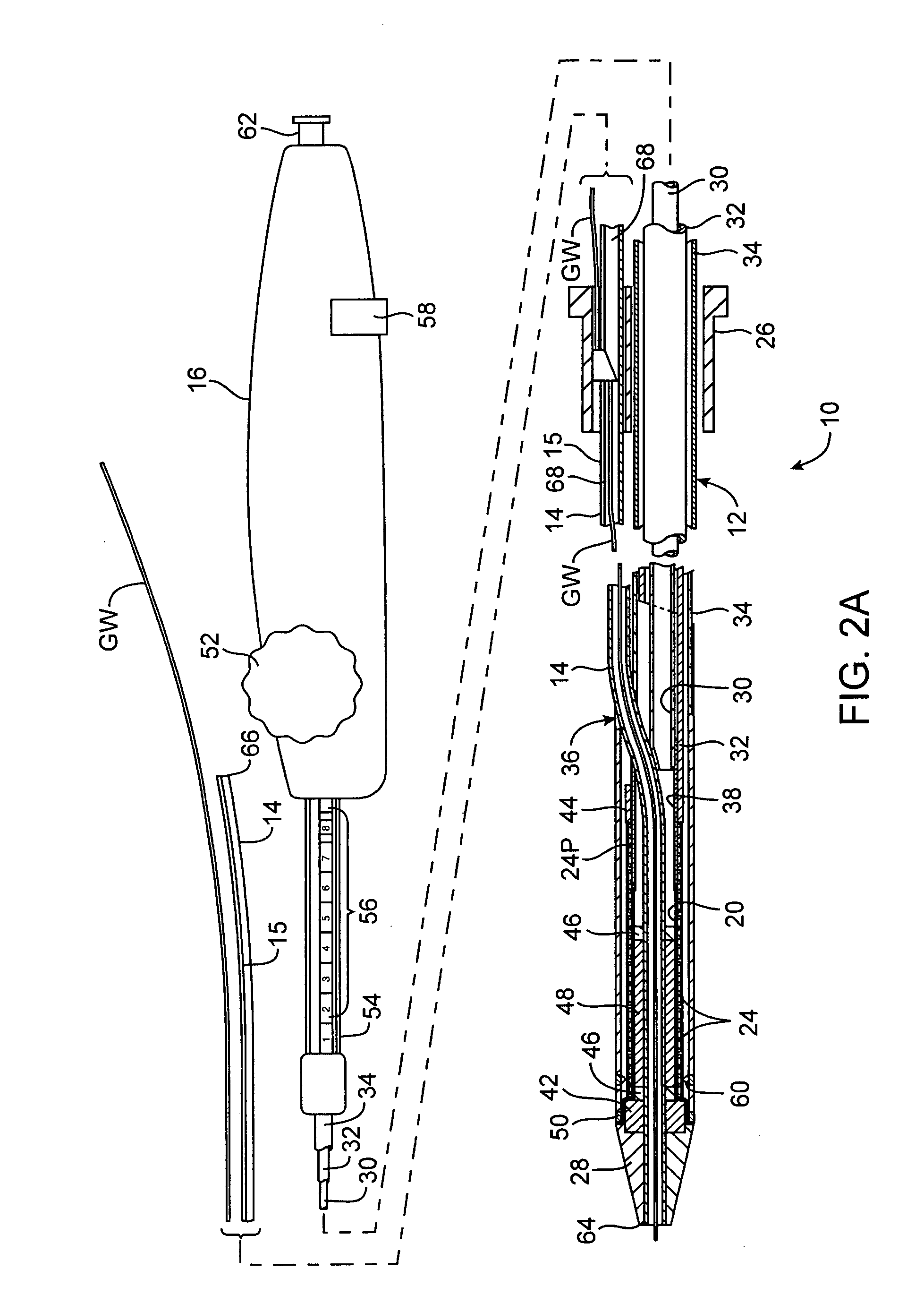 Rapid exchange interventional devices and methods