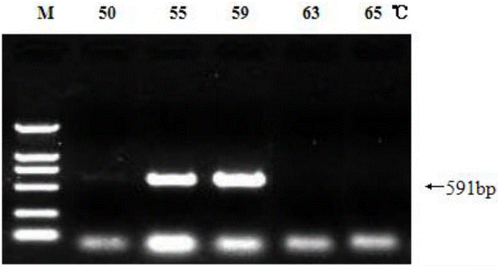 Primer for detecting potato ralstonia solancearum and PCR detection method adopted by primer