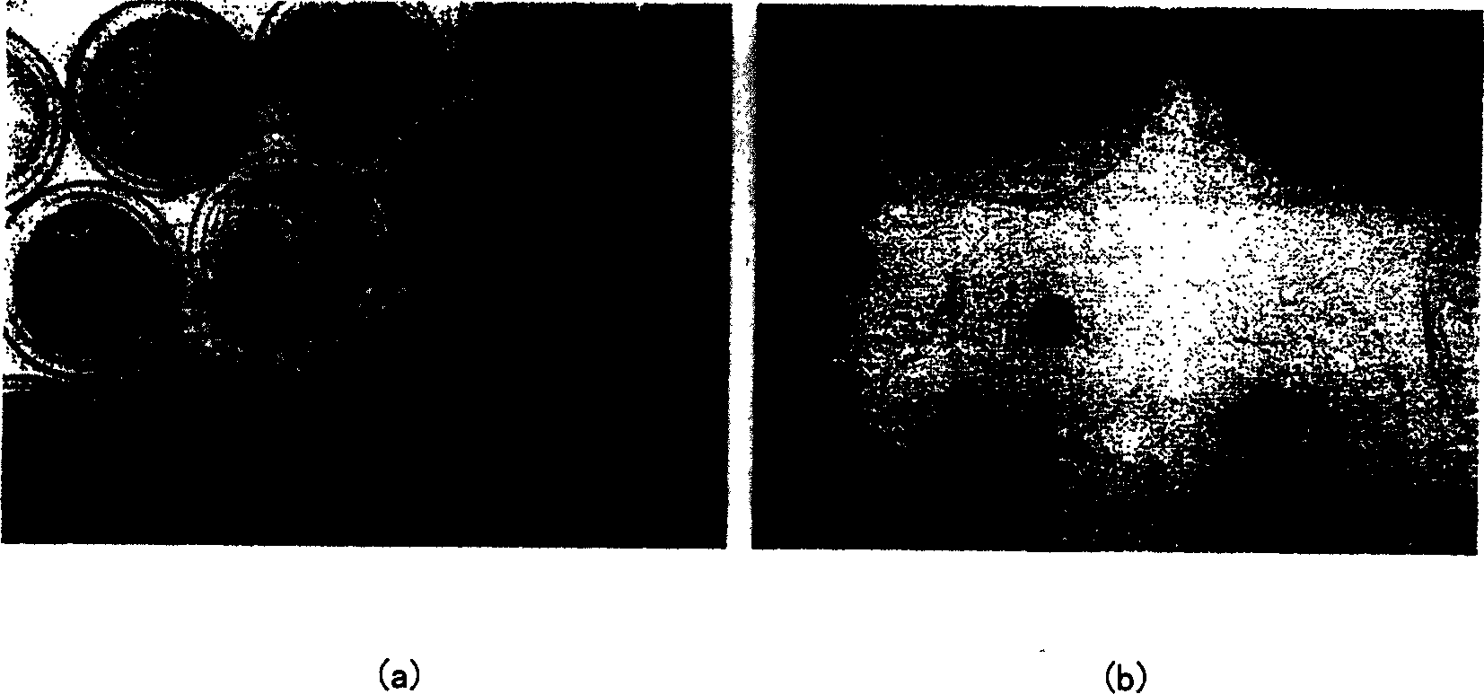 Method for preparing fixed yeast cell micro capsule