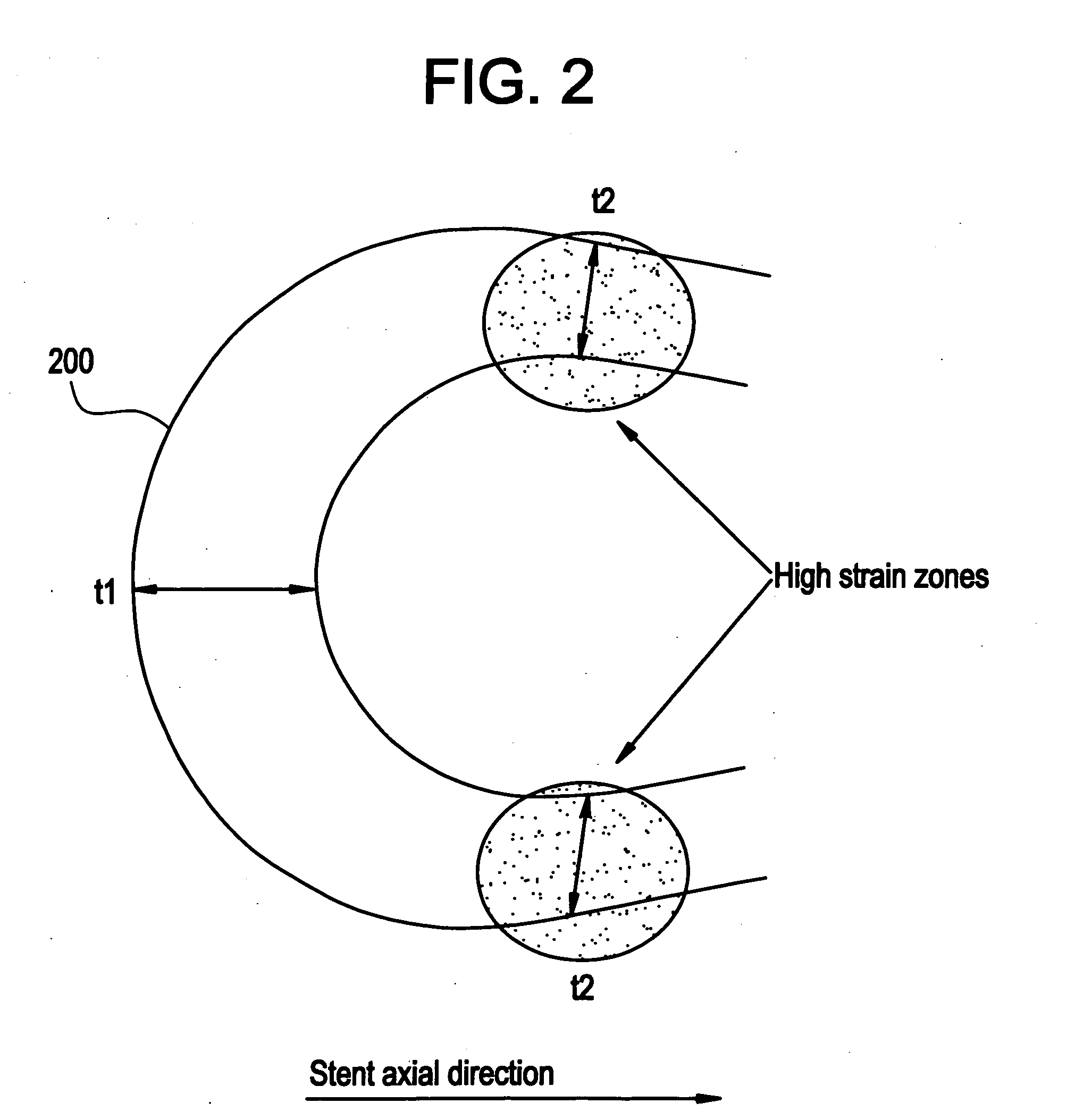 Polymeric stent having modified molecular structures in both the hoops and selected segments of the flexible connectors