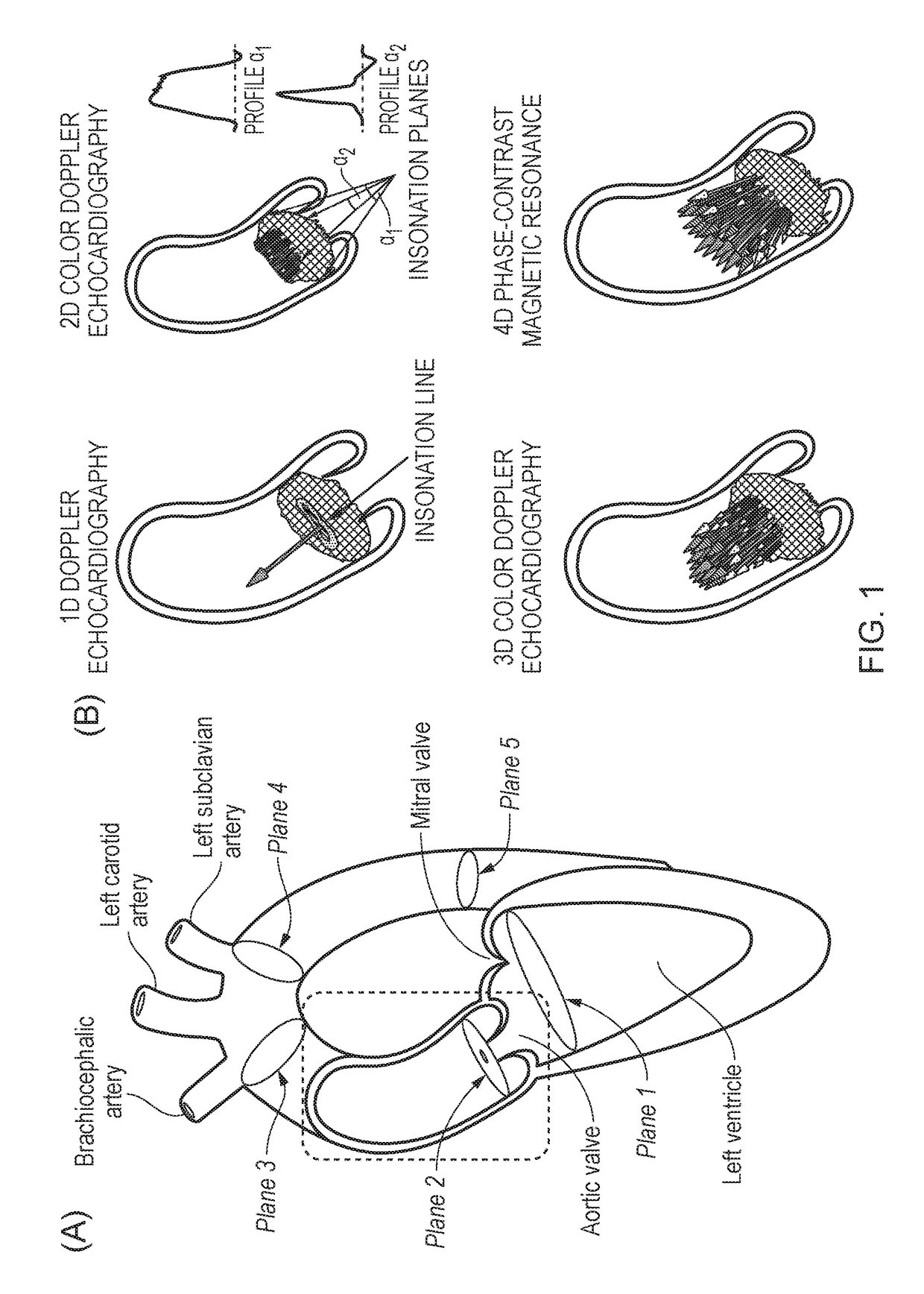 Method and System for Pressure Drop Estimation