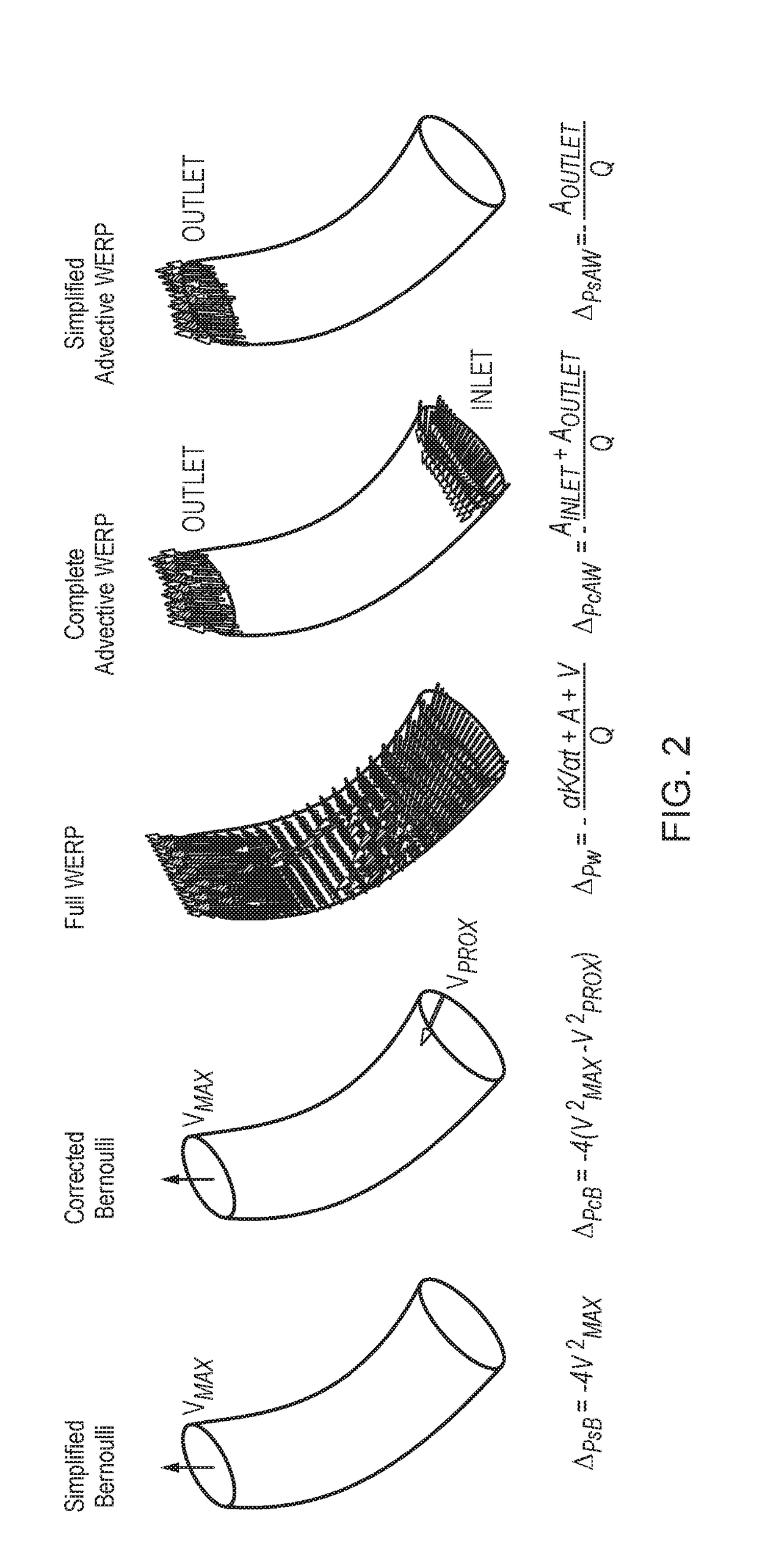 Method and System for Pressure Drop Estimation