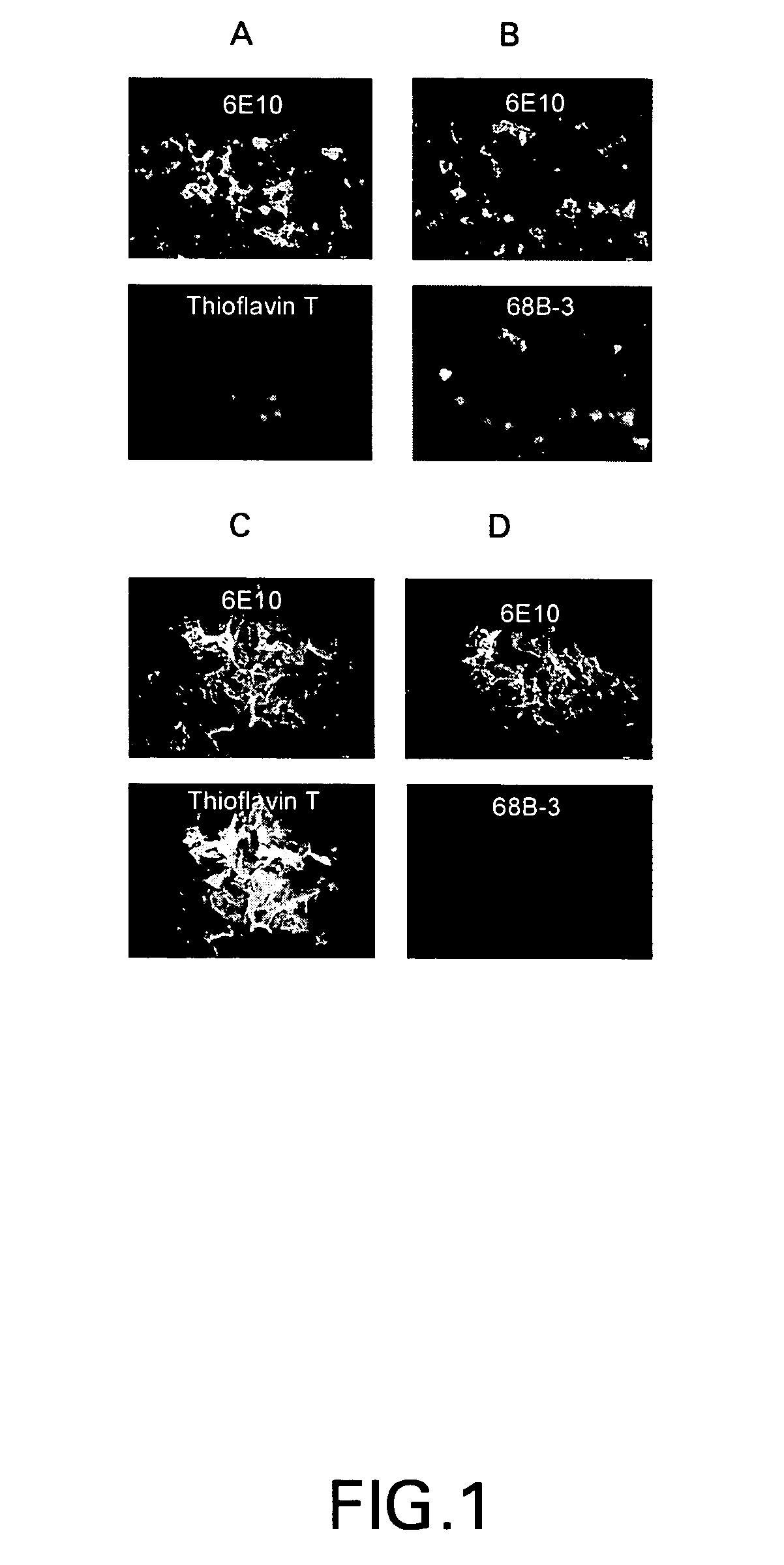 Amyloid binding assays