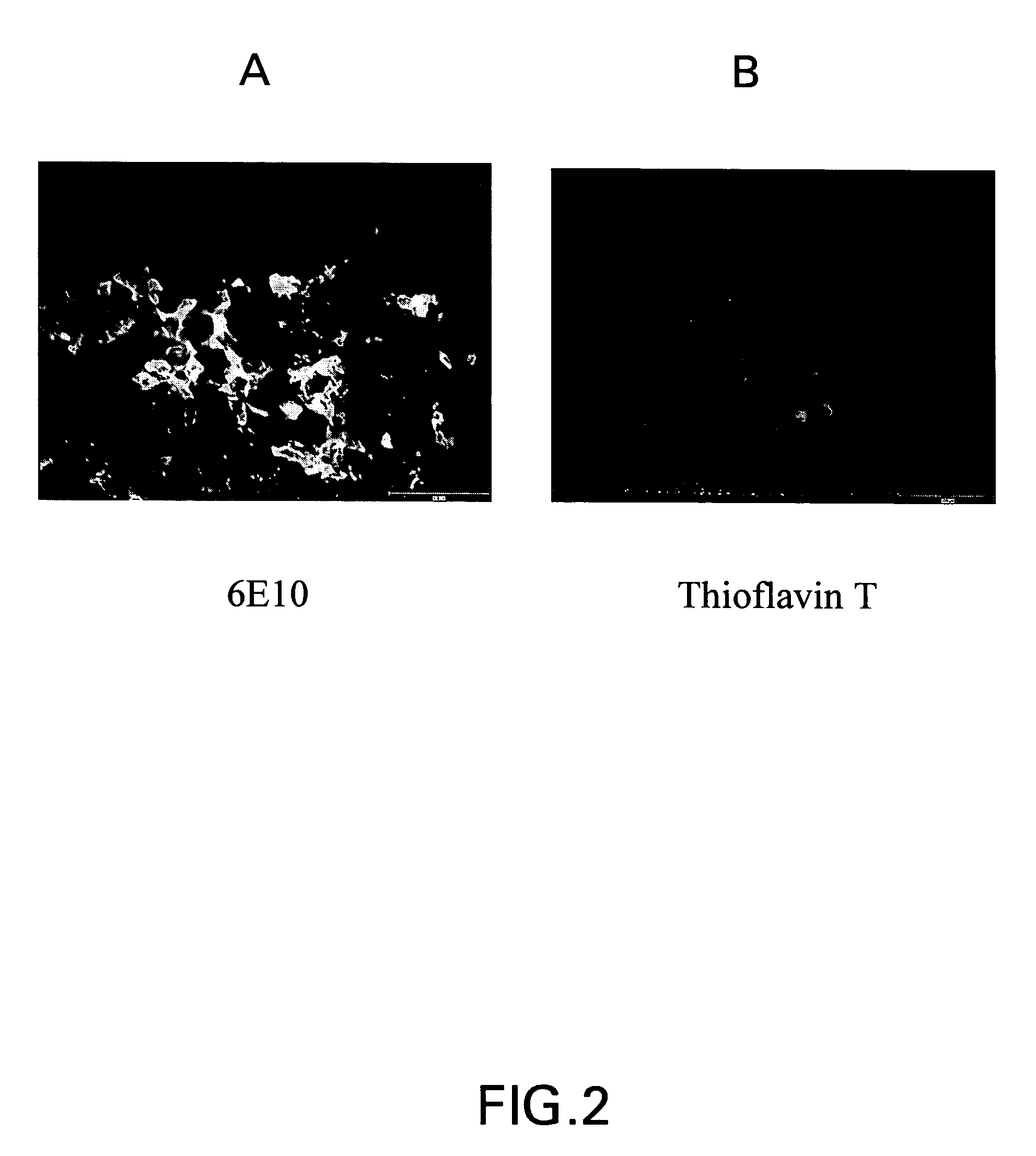 Amyloid binding assays