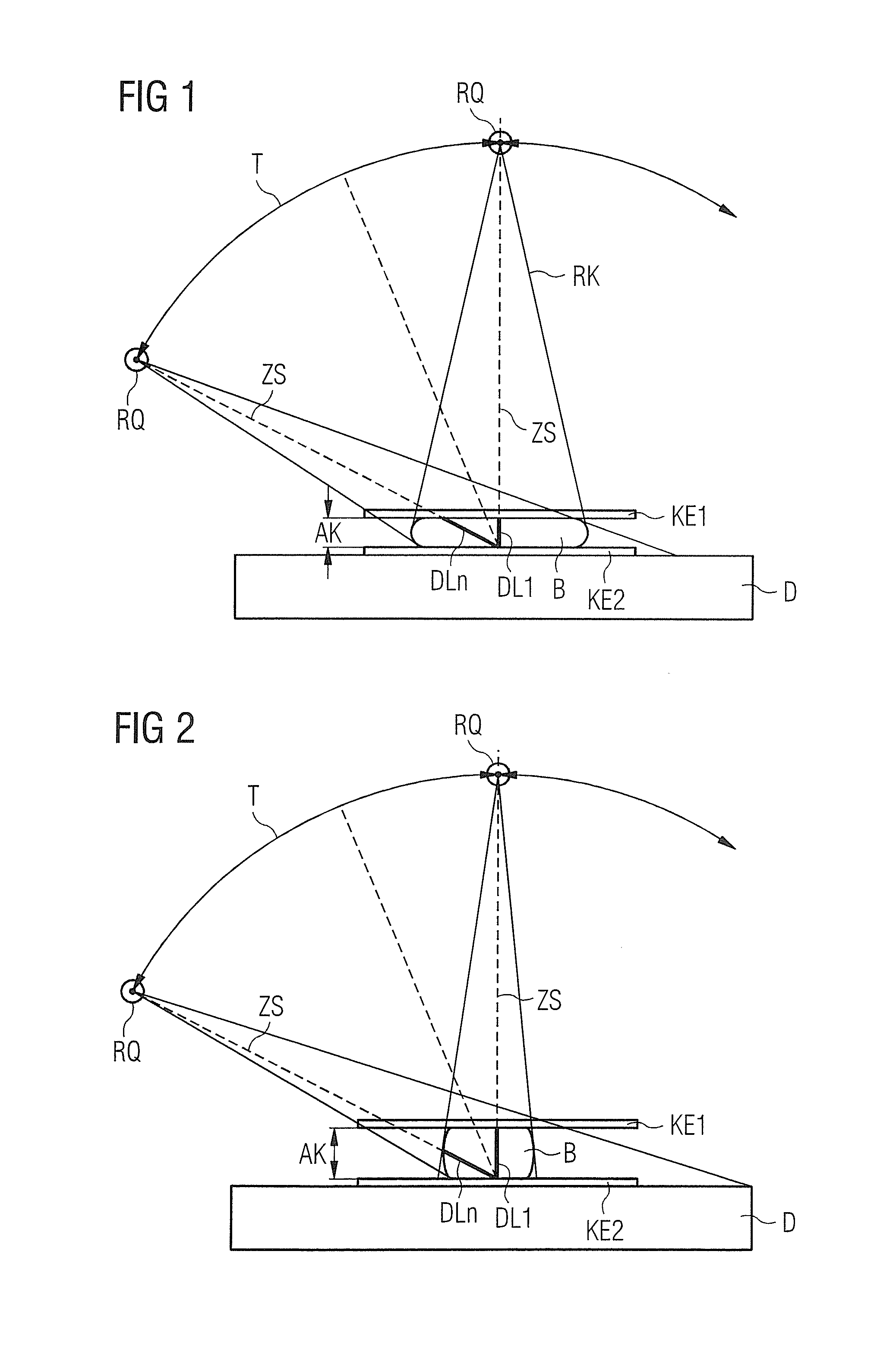 Mammography apparatus