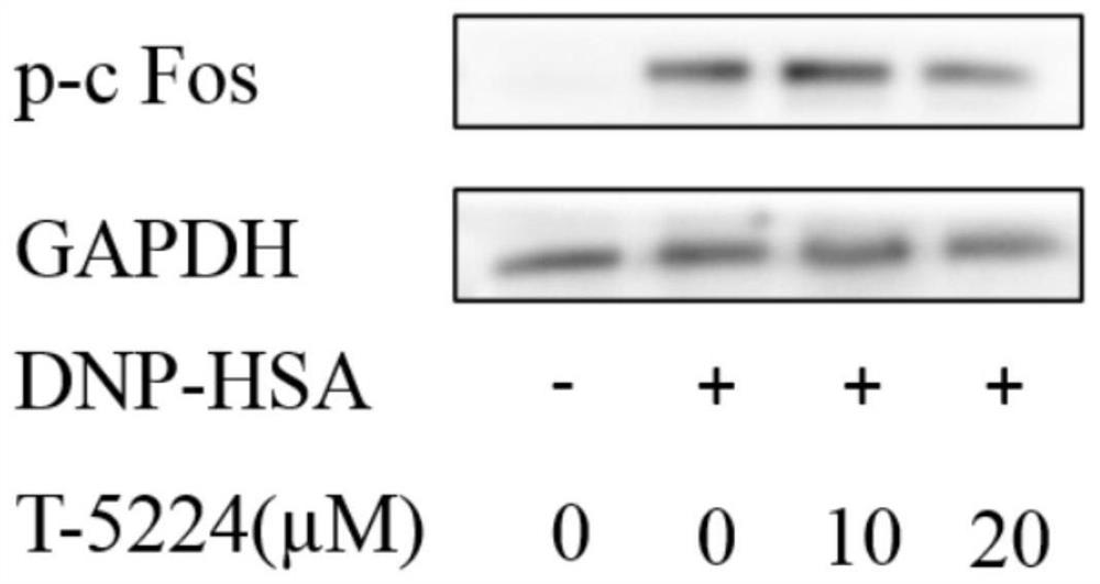 Application of a compound in the preparation of antiallergic drugs