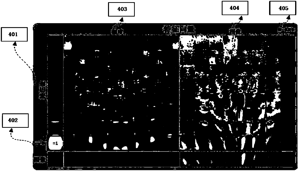 Magnetic resonance reconstruction method based on deep learning and convex set projection