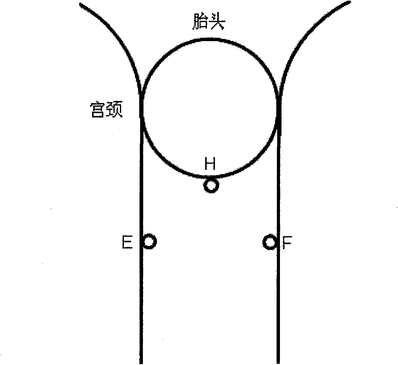 Device and method for supervising birth process