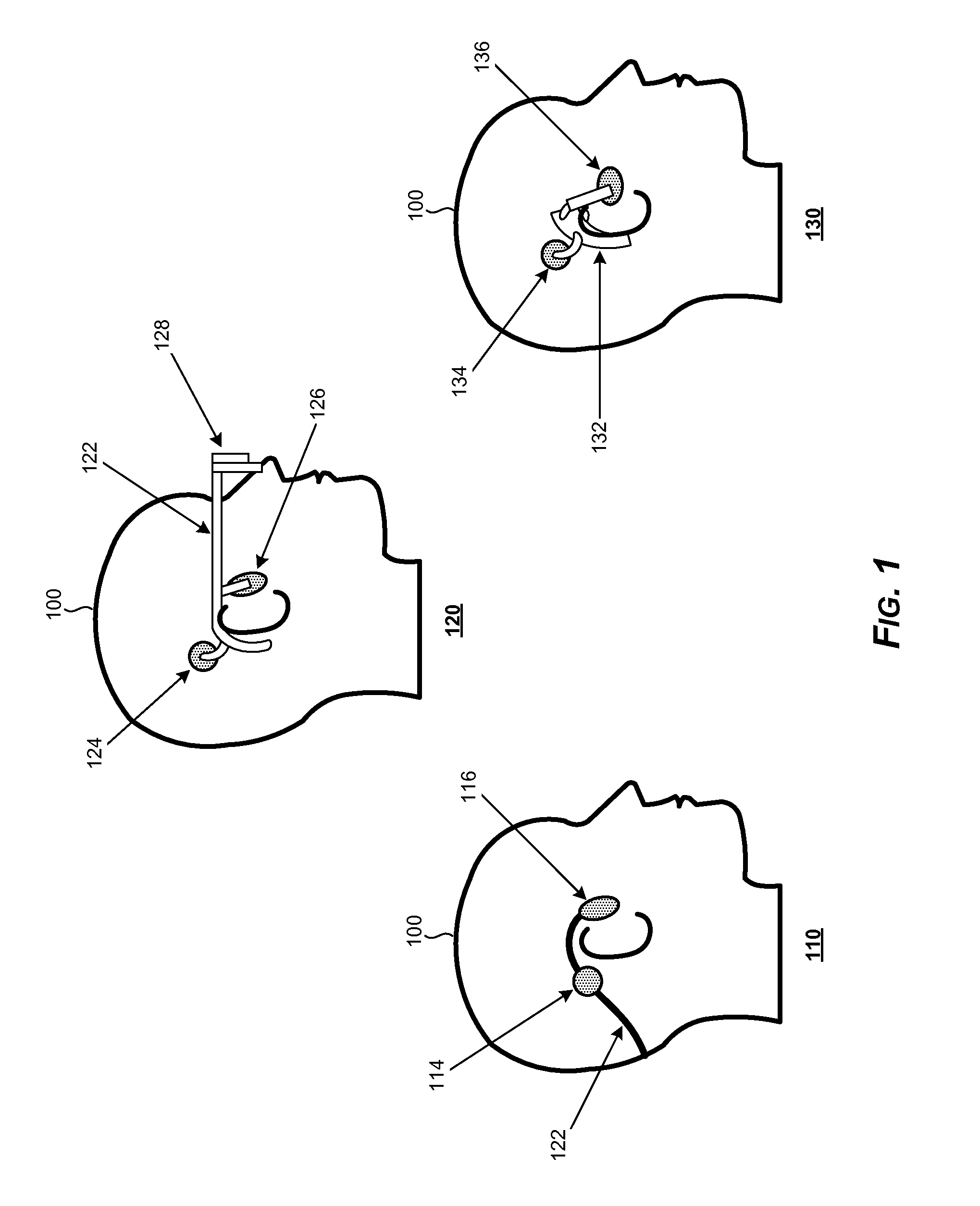 Indication of quality for placement of bone conduction transducers