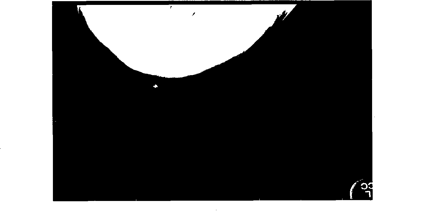 Method for determining external periphery outline of mammary gland