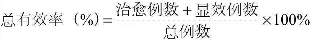 Freckle-removing lotion and preparation method thereof