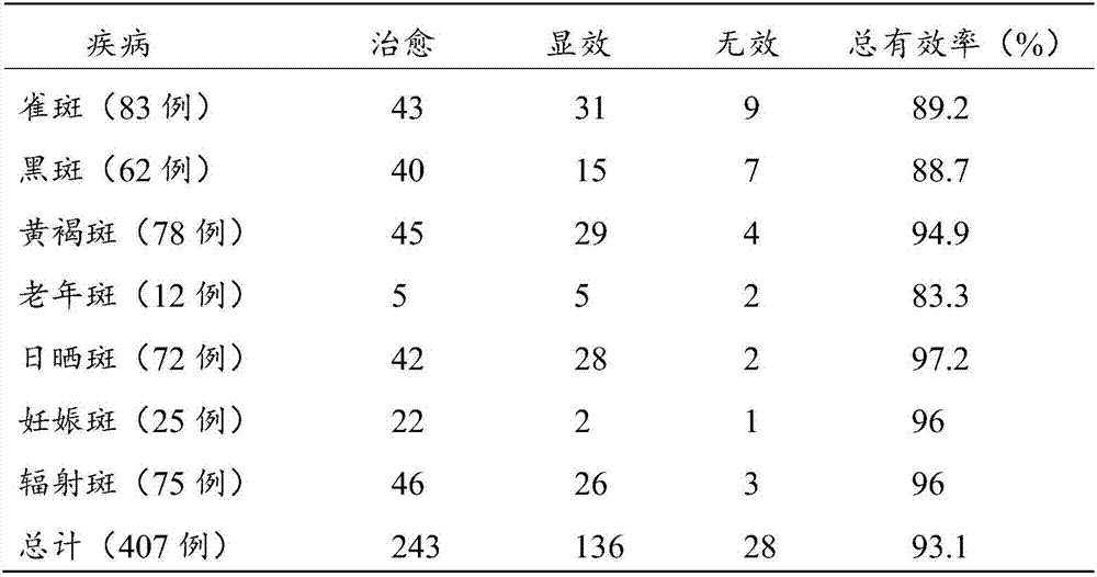 Freckle-removing lotion and preparation method thereof