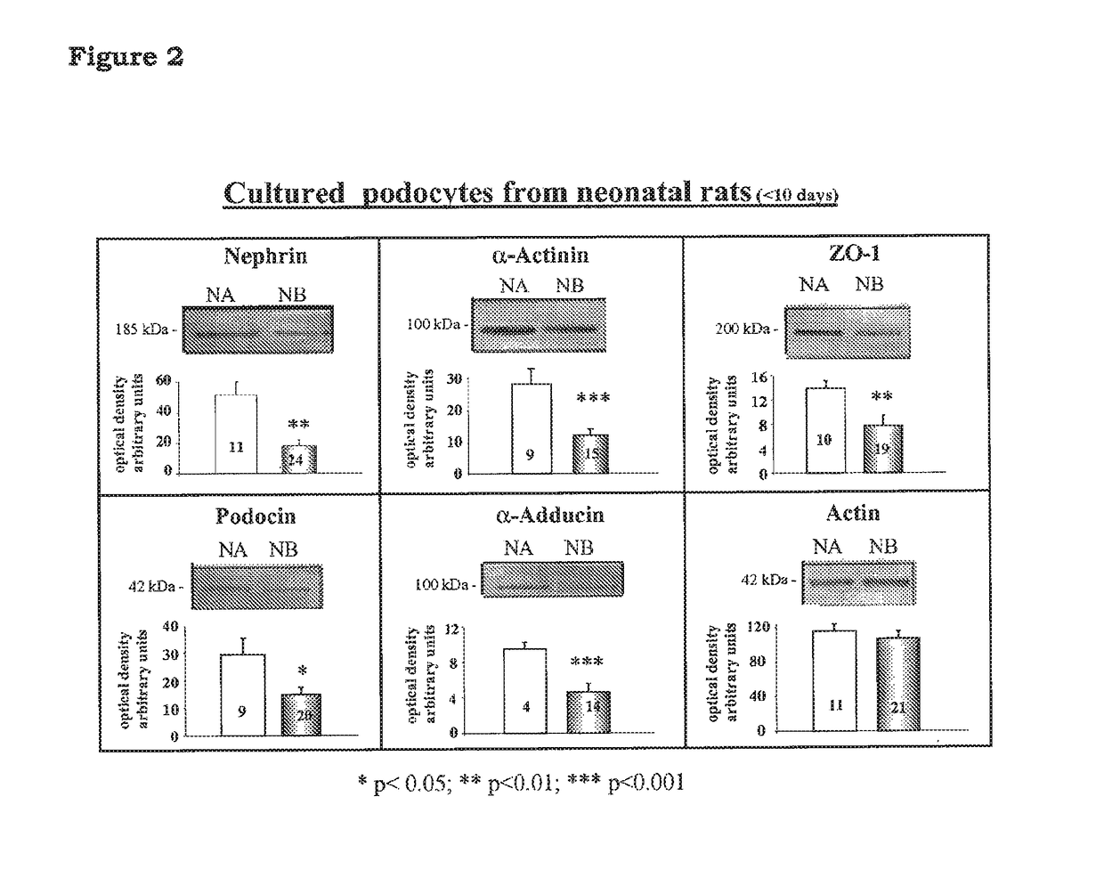 5-β, 14-β-androstane derivatives useful for the treatment of proteinuria, glomerulosclerosis and renal failure