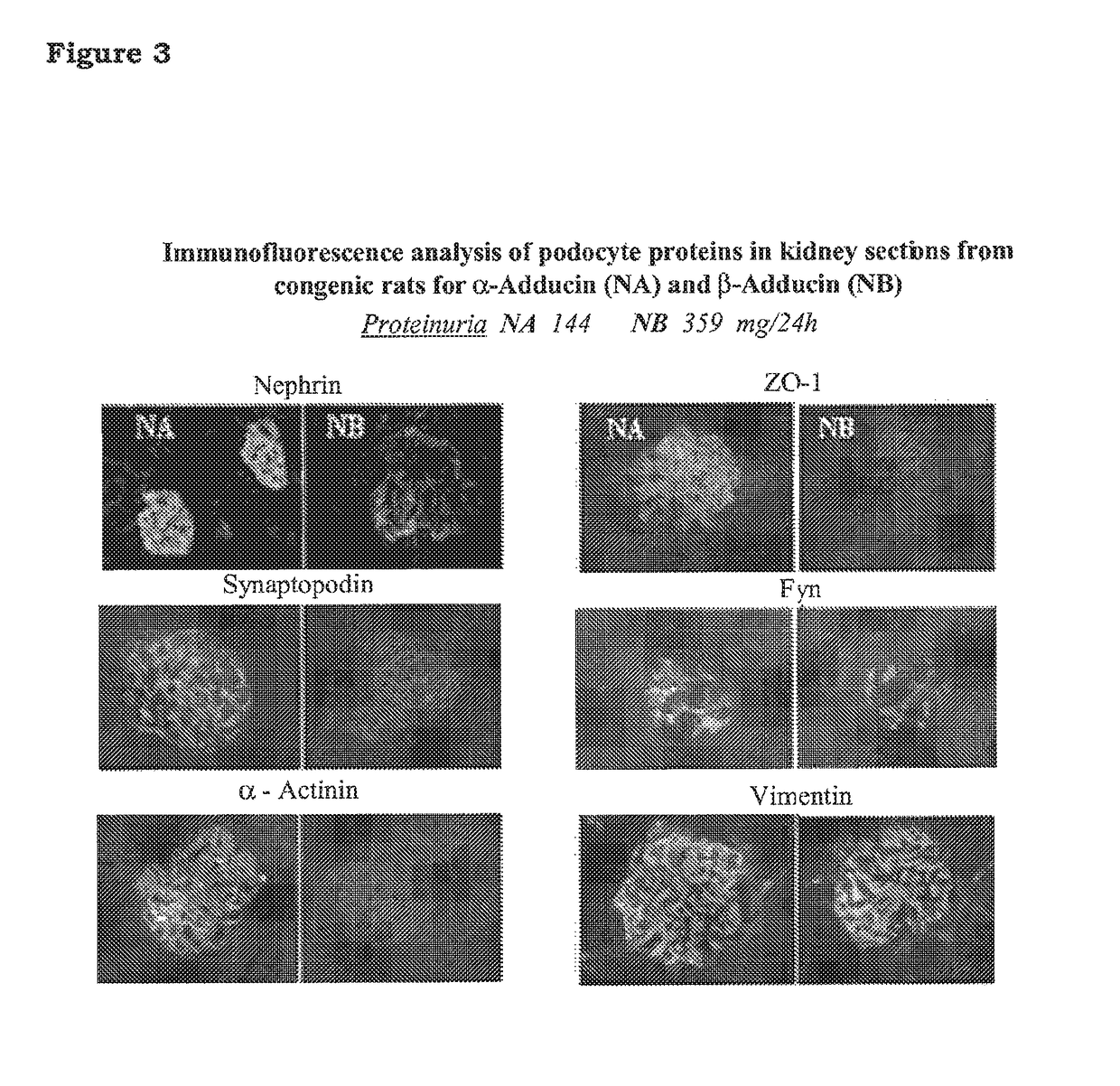 5-β, 14-β-androstane derivatives useful for the treatment of proteinuria, glomerulosclerosis and renal failure