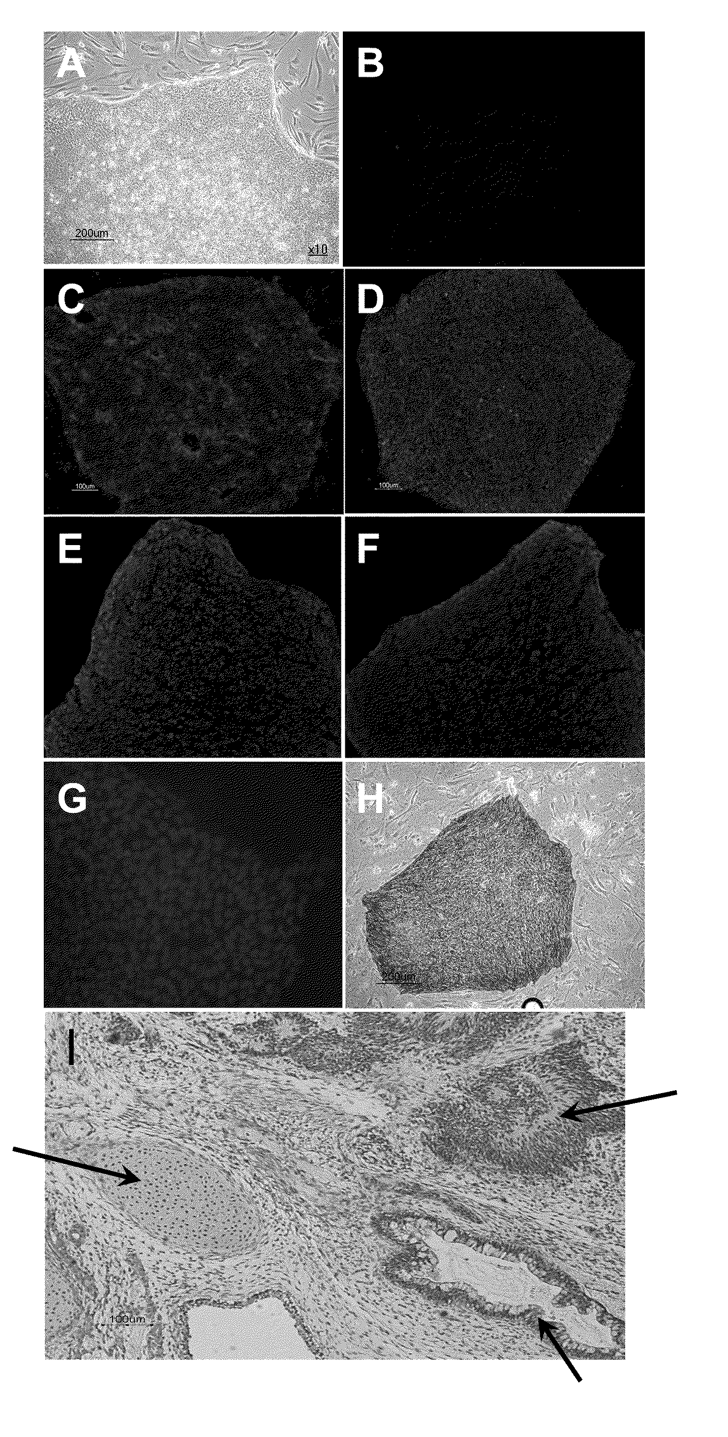 NOVEL HEPATOCYTE-LIKE CELLS AND HEPATOBLAST-LIKE CELLS DERIVED FROM hBS CELLS