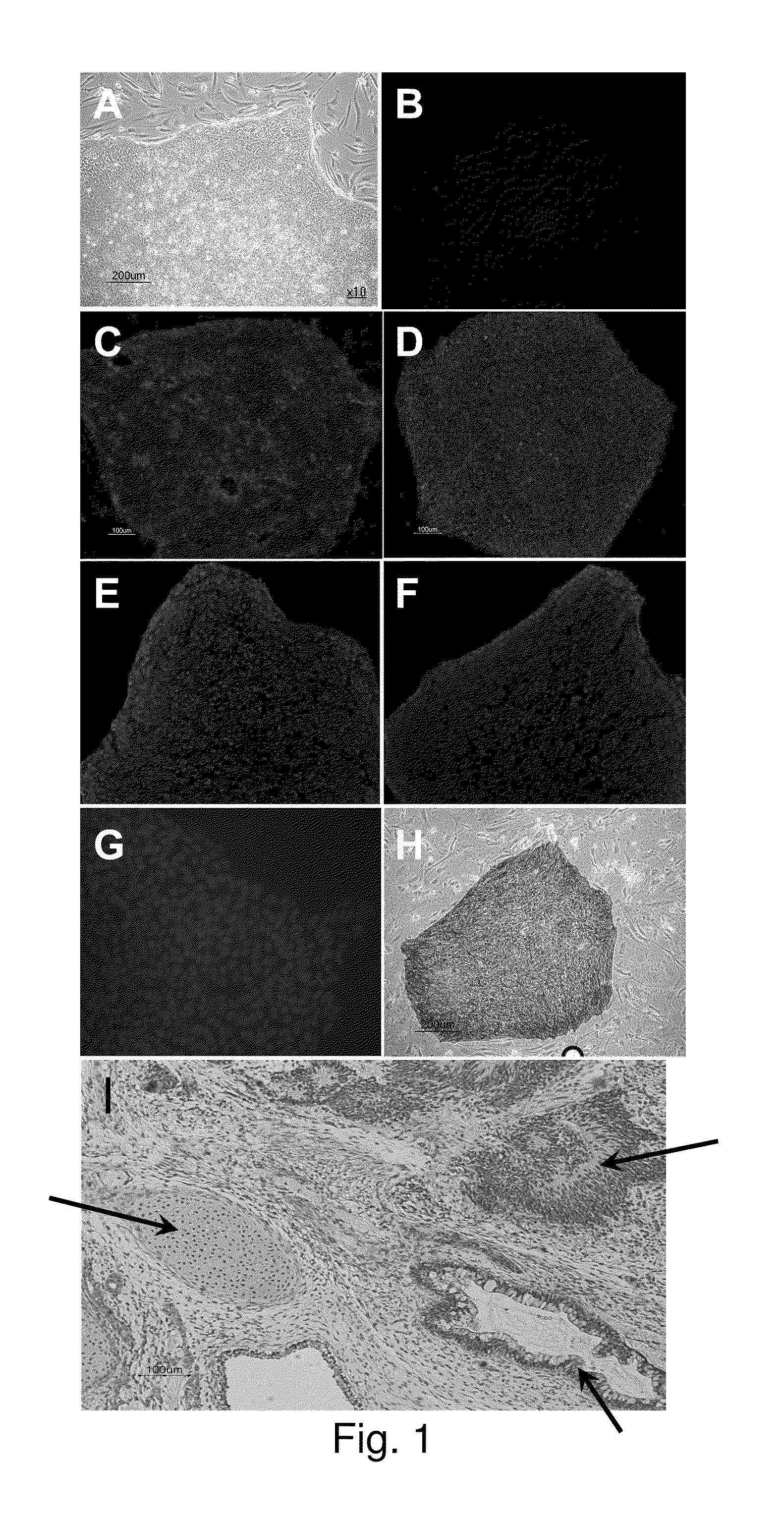 NOVEL HEPATOCYTE-LIKE CELLS AND HEPATOBLAST-LIKE CELLS DERIVED FROM hBS CELLS