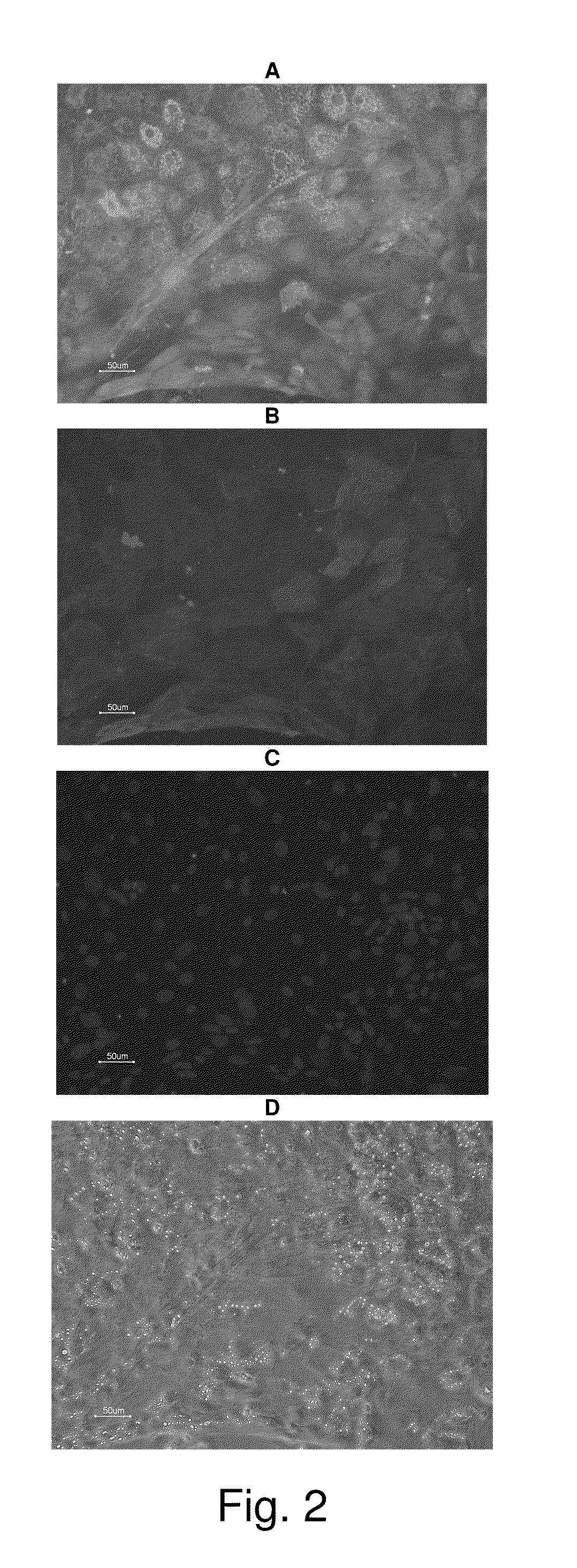 NOVEL HEPATOCYTE-LIKE CELLS AND HEPATOBLAST-LIKE CELLS DERIVED FROM hBS CELLS