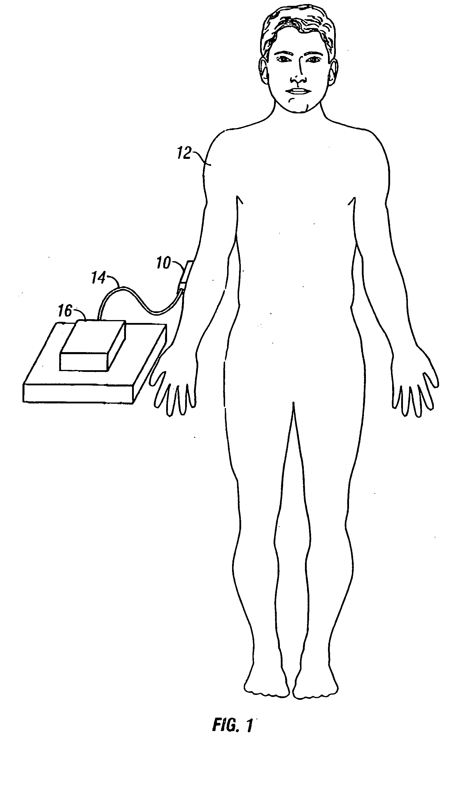 Compact apparatus for noninvasive measurement of glucose through near-infrared spectroscopy