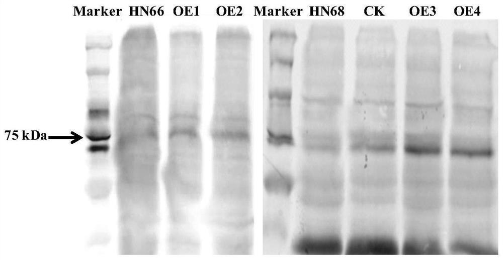 Application of Soybean Purple Acid Phosphatase Gene gmpap35