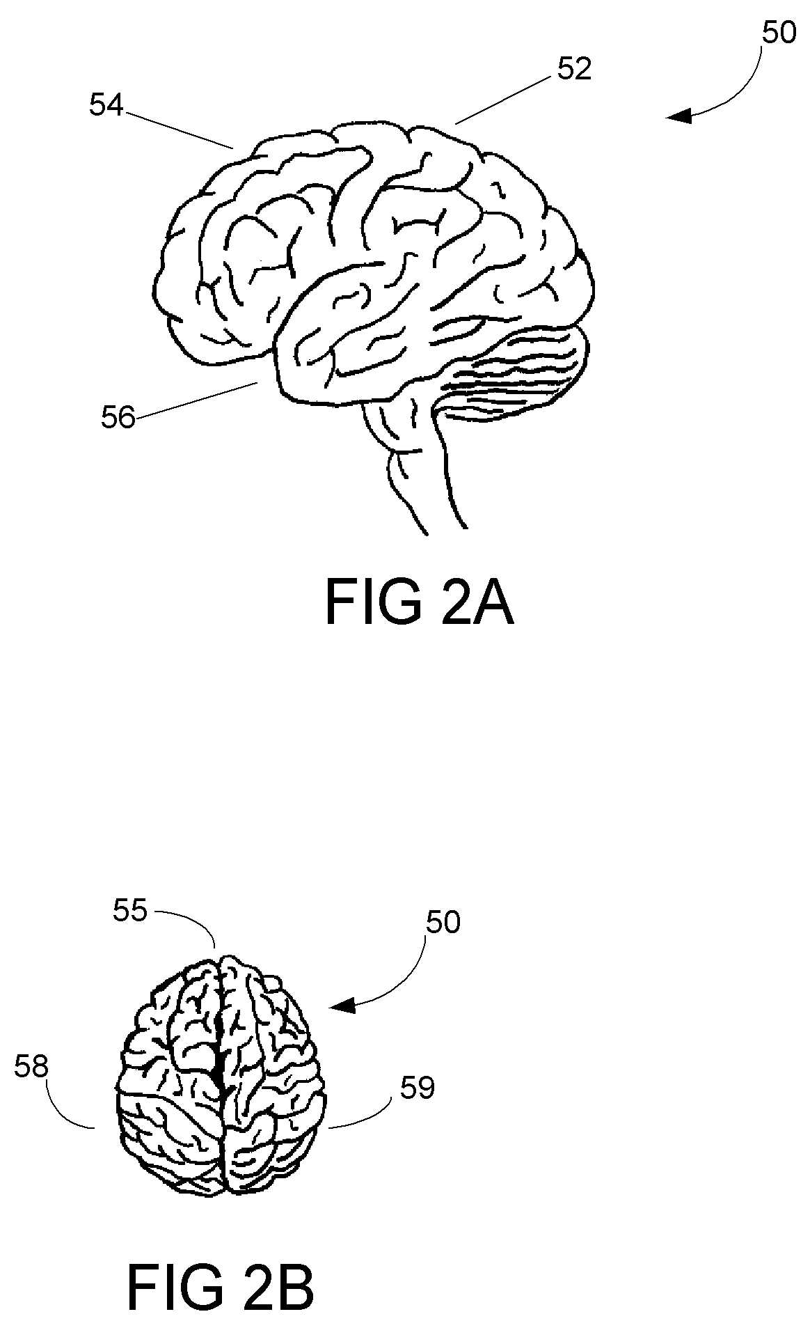 Articulated neural electrode assembly