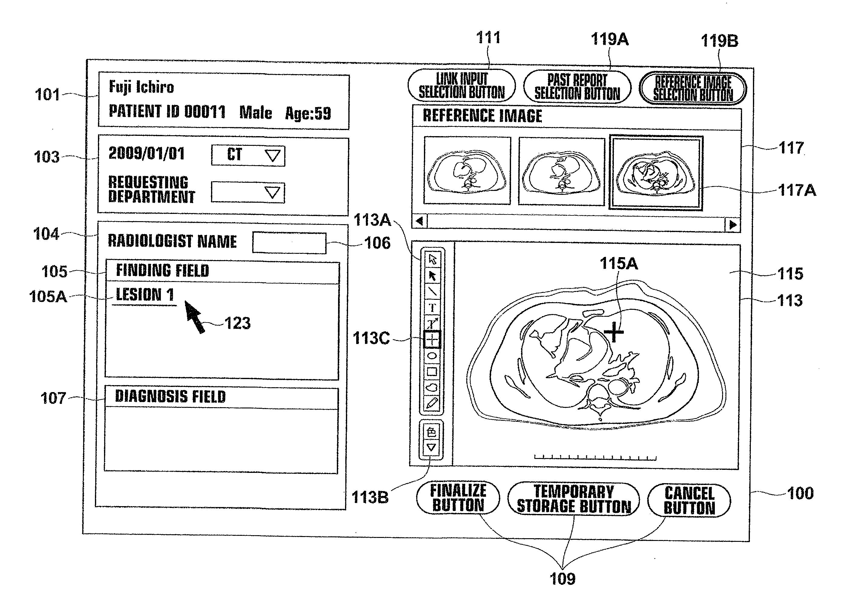 Medical image display apparatus, method, and program