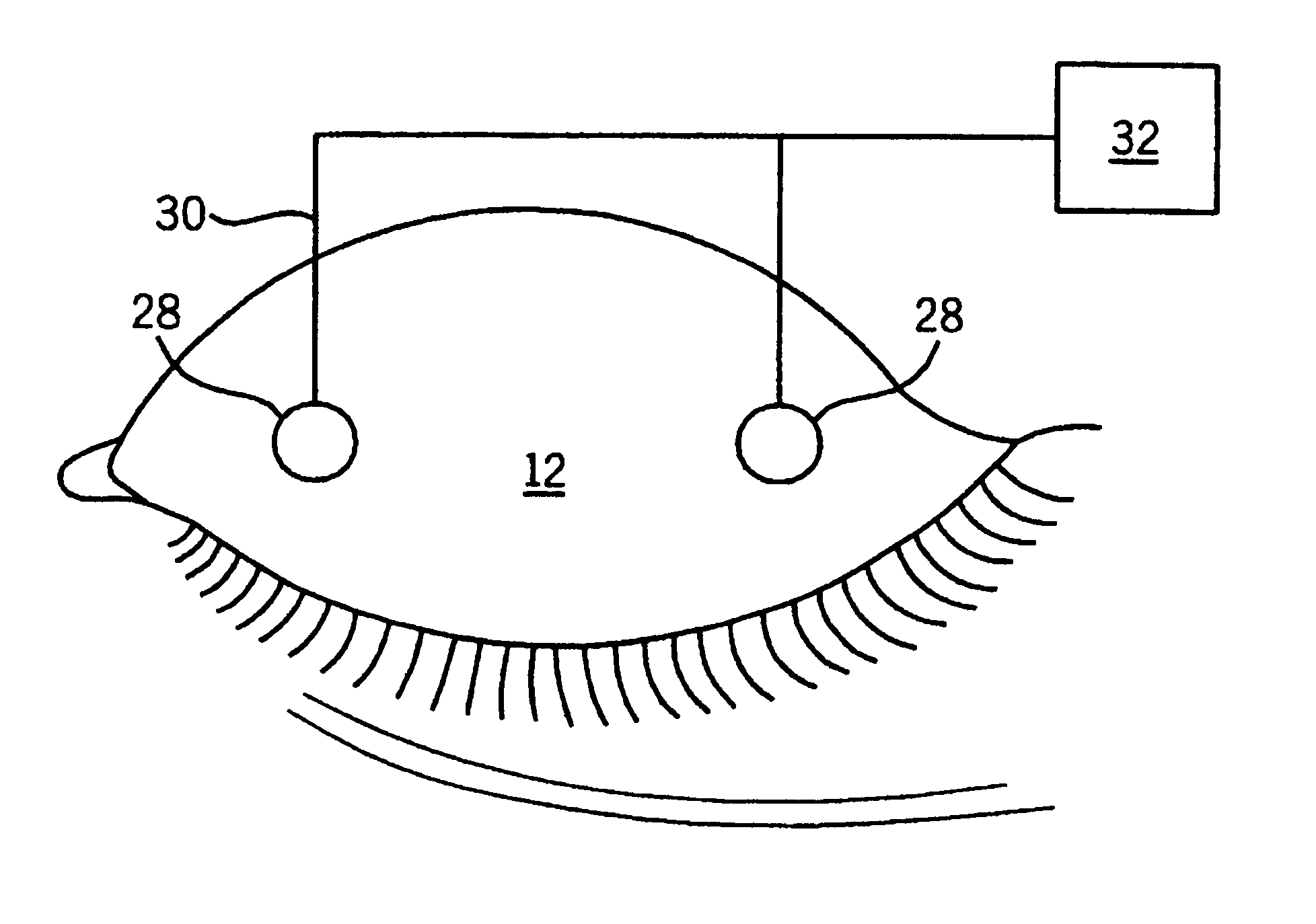 Method and apparatus for preventing and treating eyelid problems