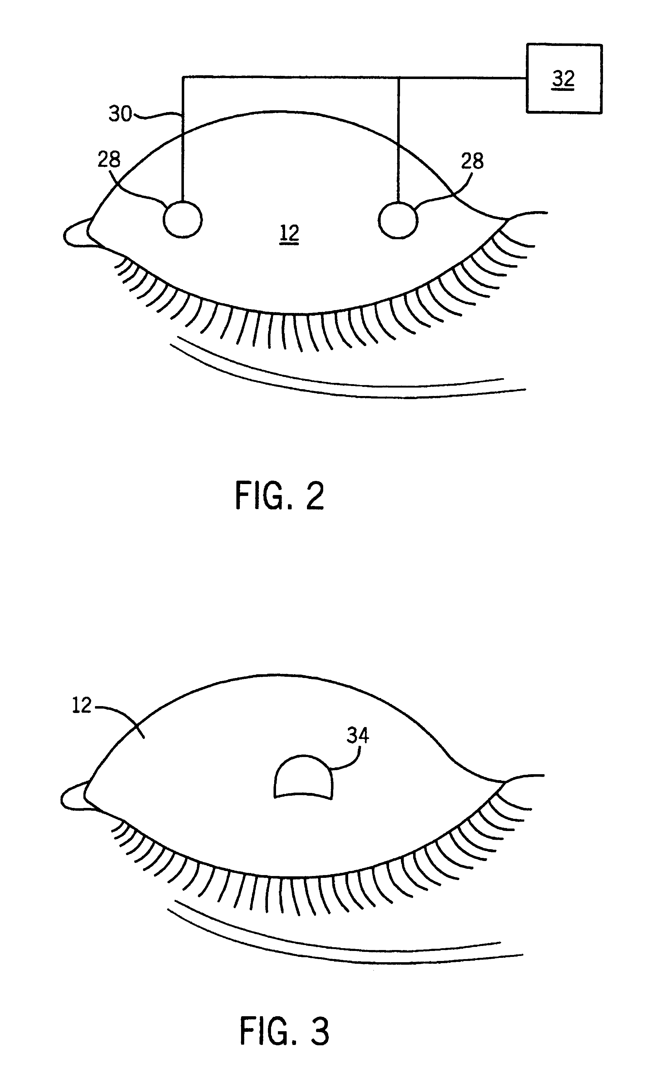 Method and apparatus for preventing and treating eyelid problems