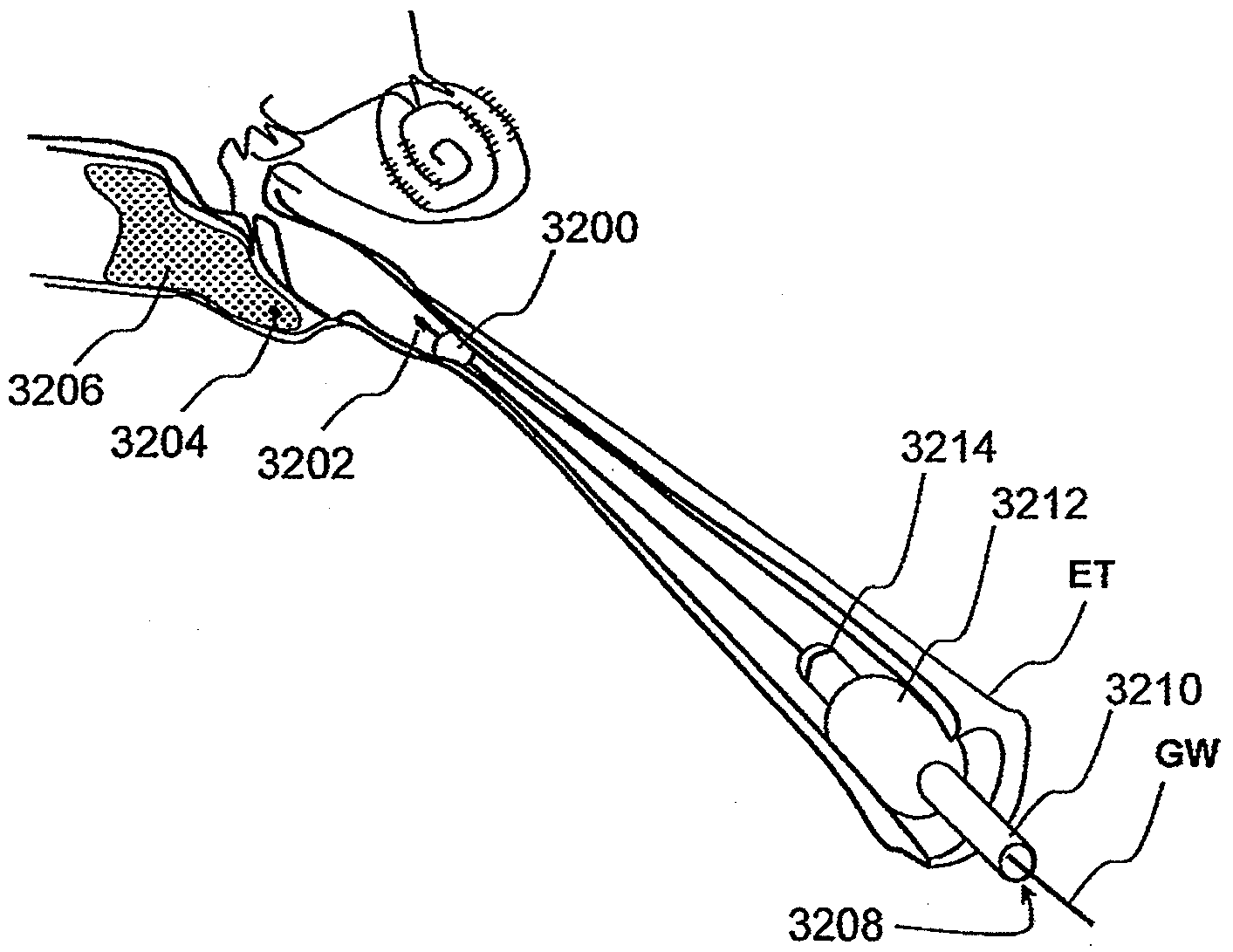 Method and System for Accessing, Diagnosing and Treating Target Tissue Regions Within the Middle Ear and the Eustachian Tube