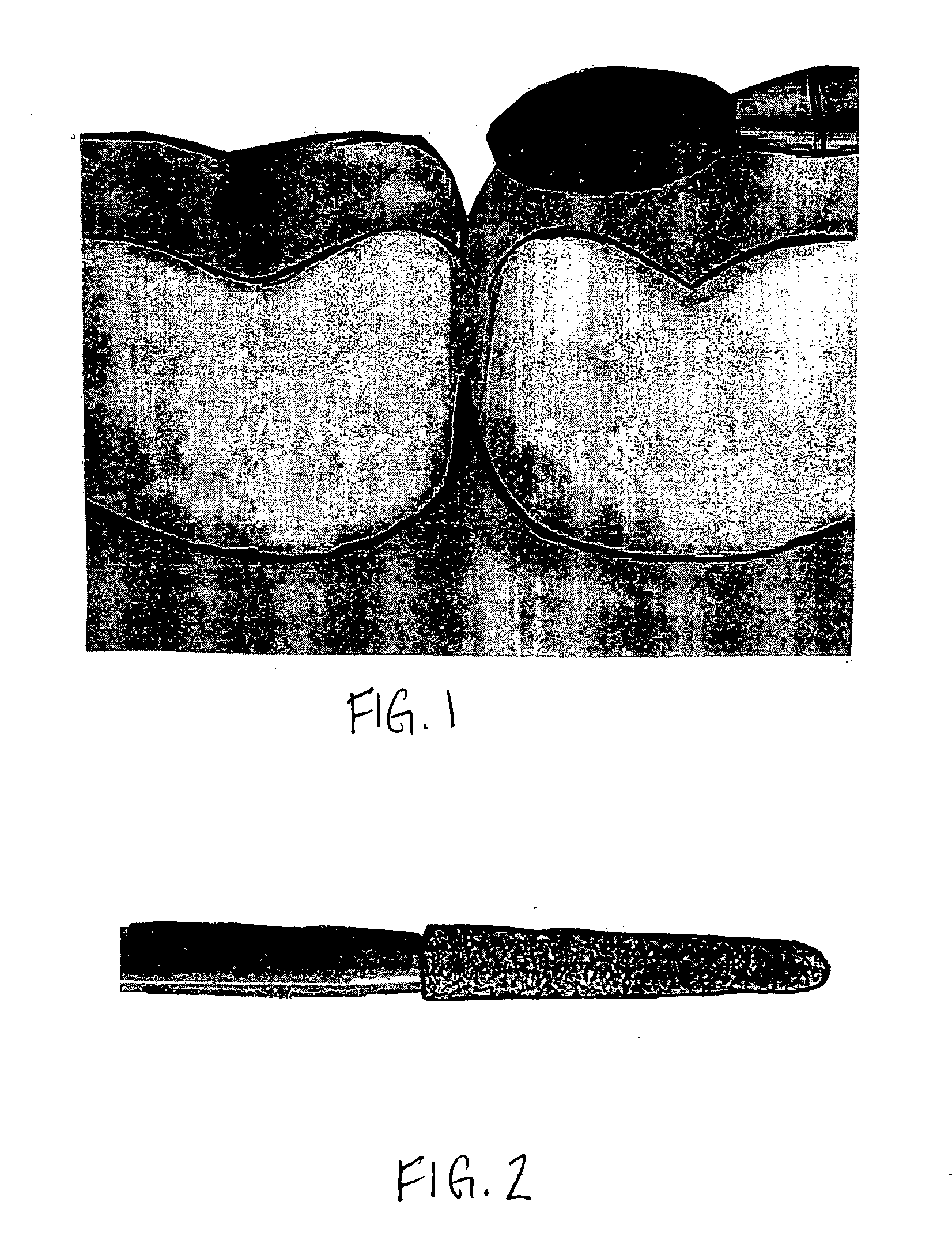 Dental instruments having durable coatings