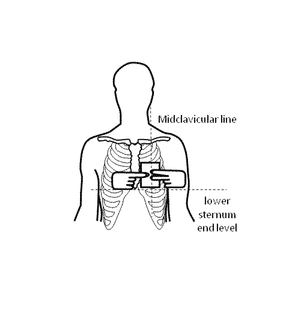 Mobile three-lead cardiac monitoring device and method for automated diagnostics