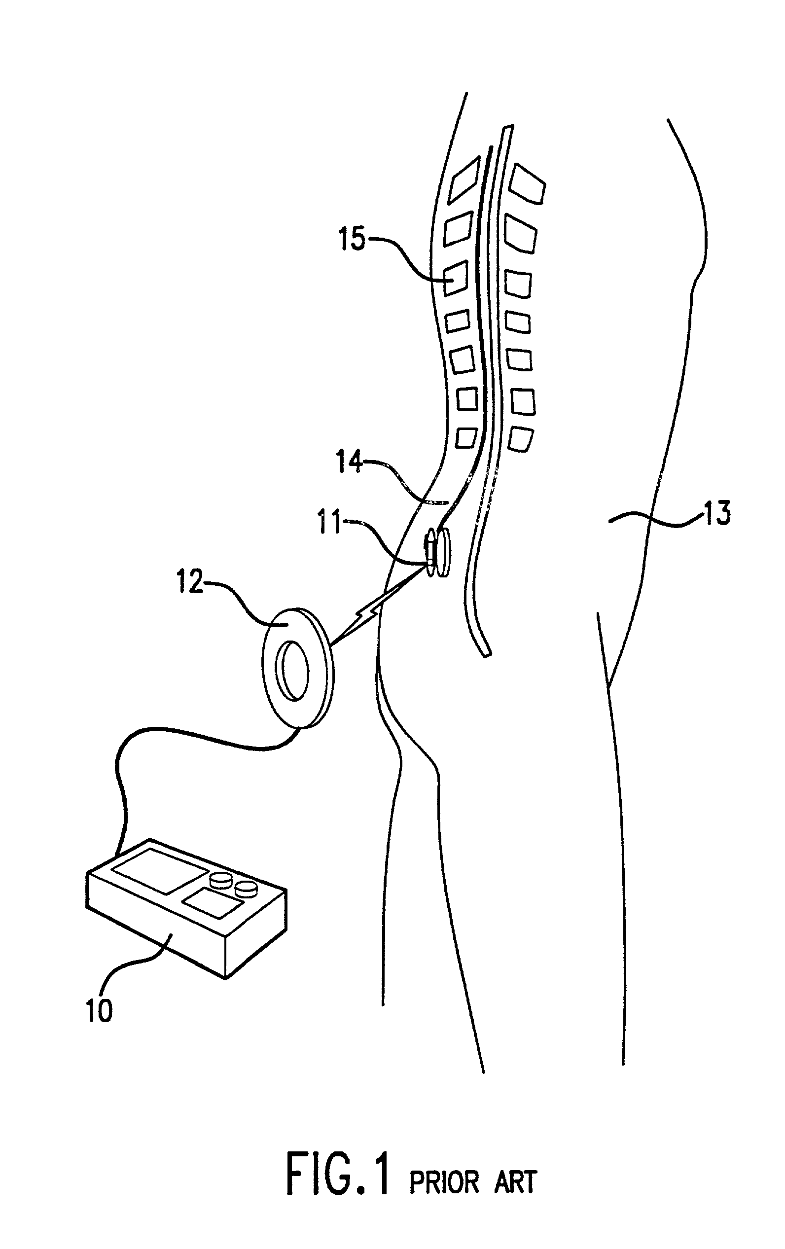 Patient interactive neurostimulation system and method