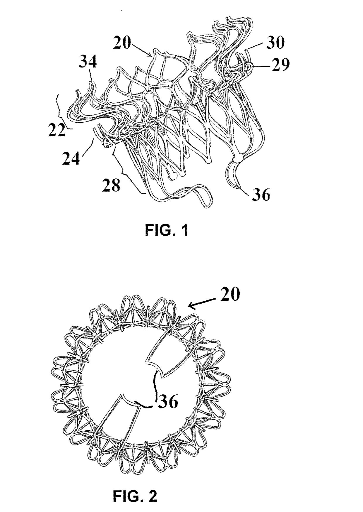 Device and method for mitral valve regurgitation treatment