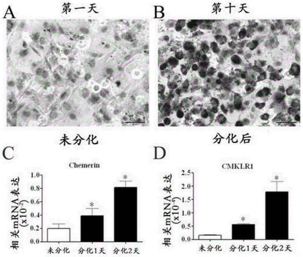 Application of CMKLR1 micromolecule antagonist to control obesity and obesity metabolic syndrome