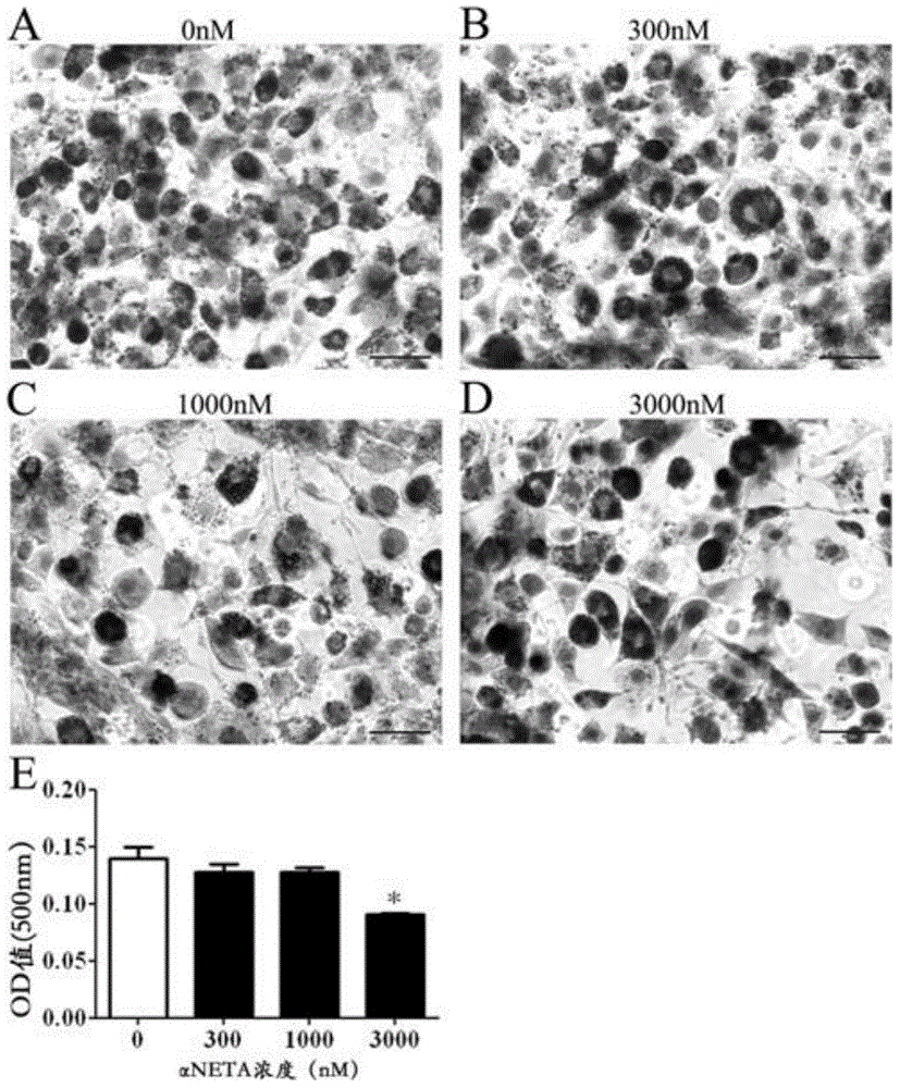 Application of CMKLR1 micromolecule antagonist to control obesity and obesity metabolic syndrome