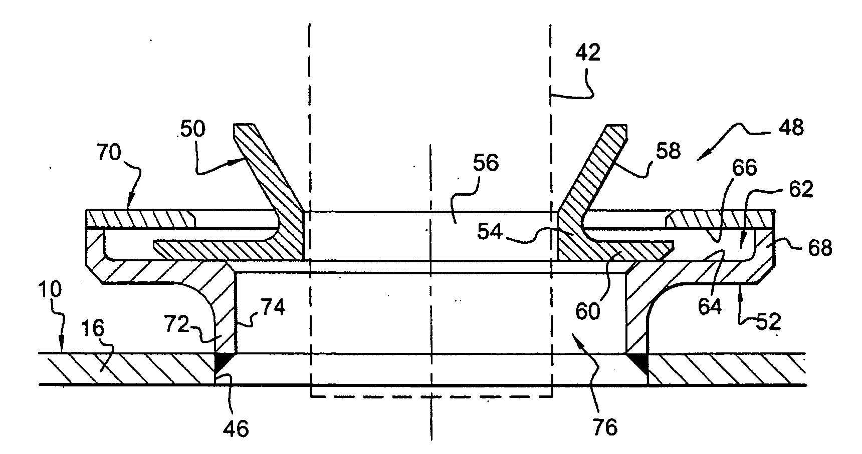 Device for guiding an element in an orifice in a wall of a turbomachine combustion chamber