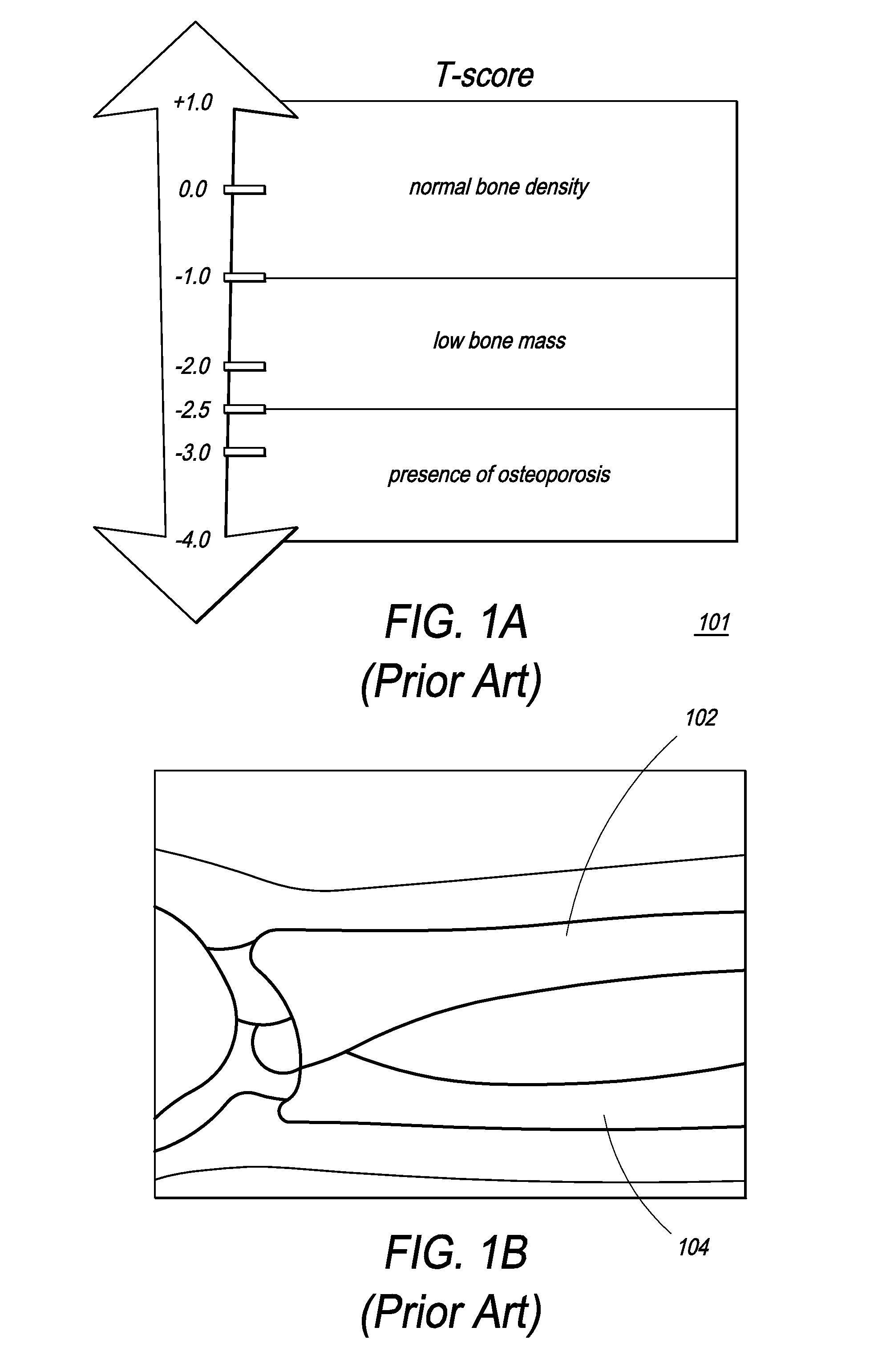 Apparatus for bone density assessment and monitoring