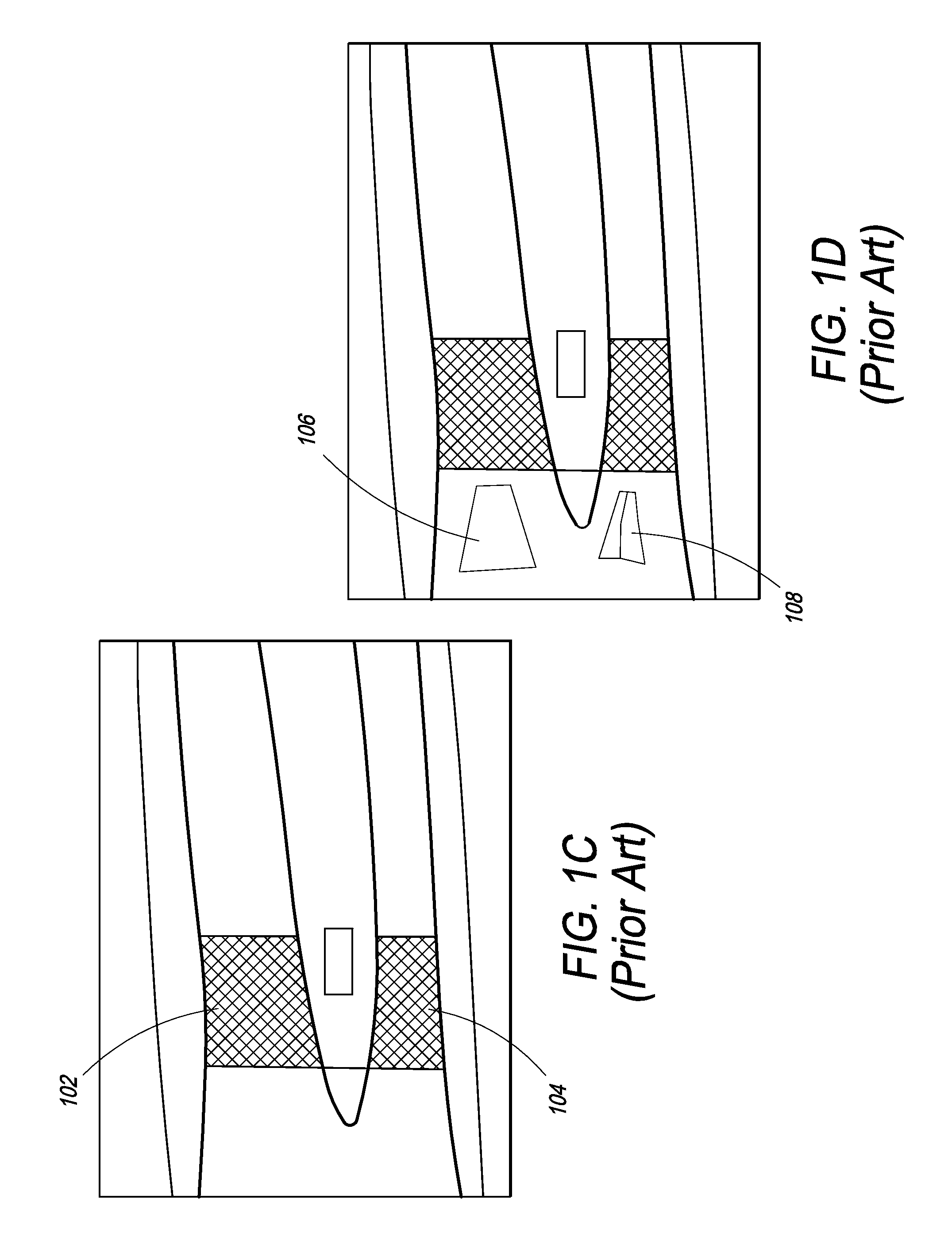 Apparatus for bone density assessment and monitoring