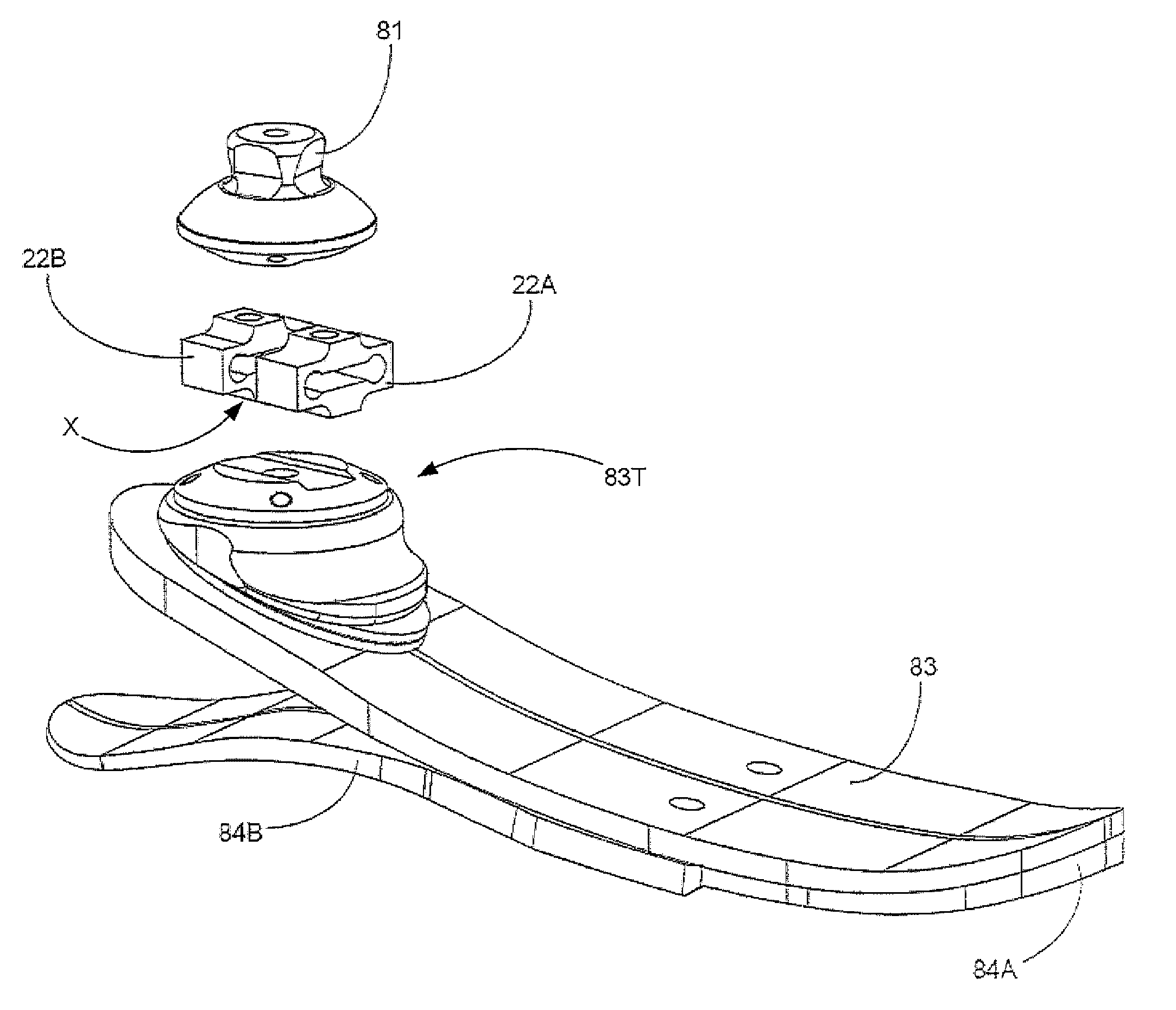 Instrumented prosthetic foot